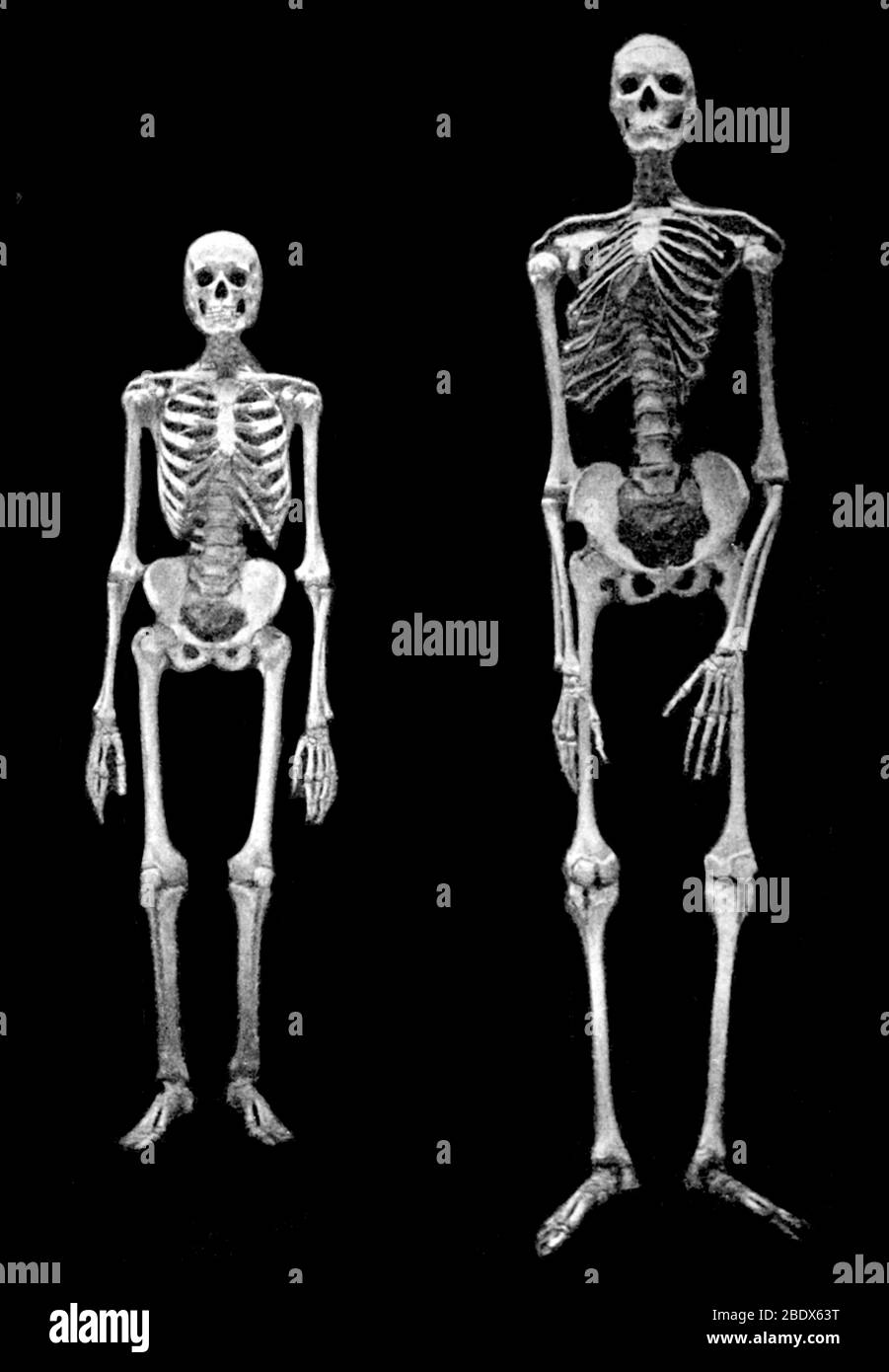 Skelette, Normal und der amerikanische Riese, 1898 Stockfoto