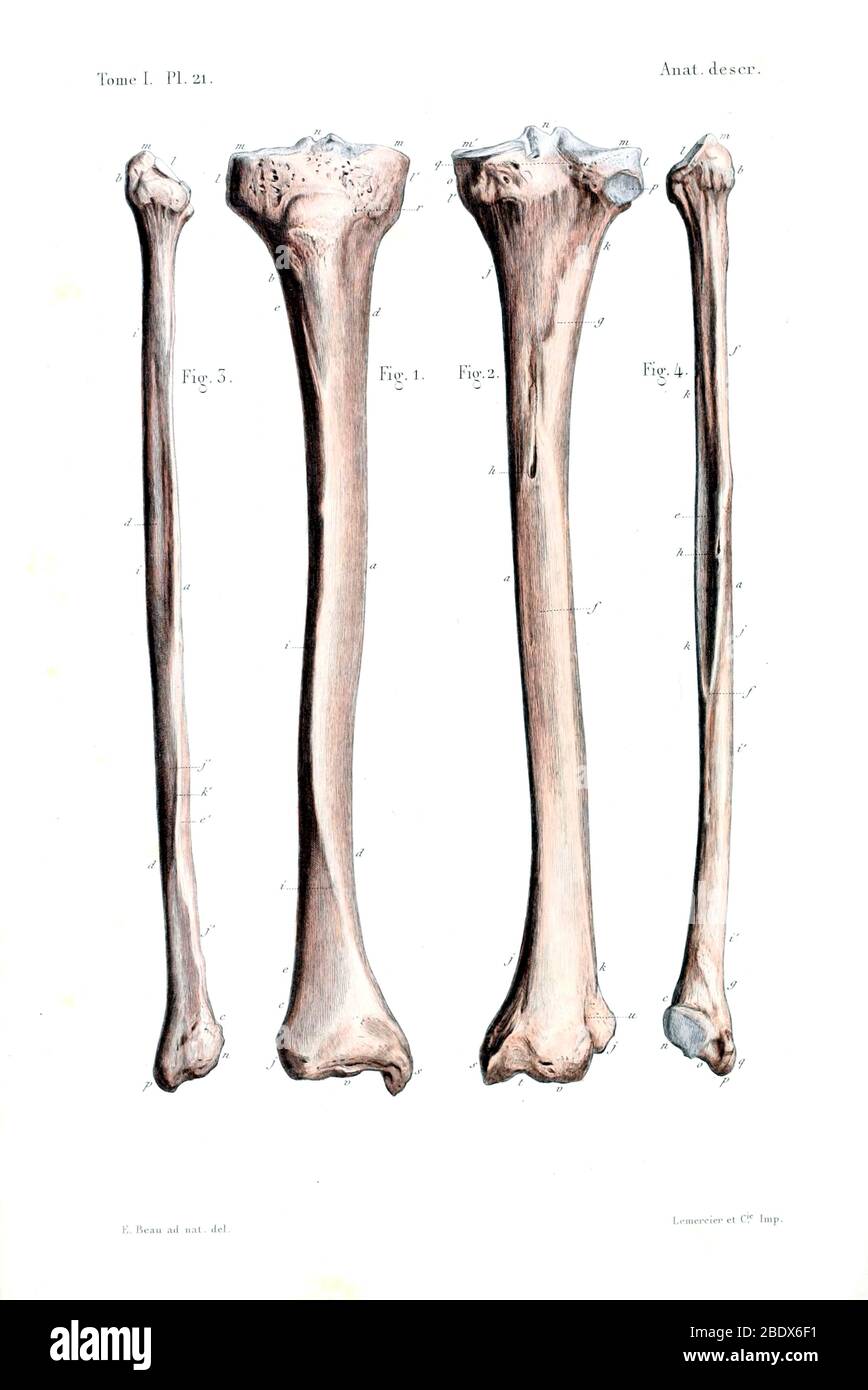 Menschliche Tibia und Fibula-Knochen, 1844 Stockfoto