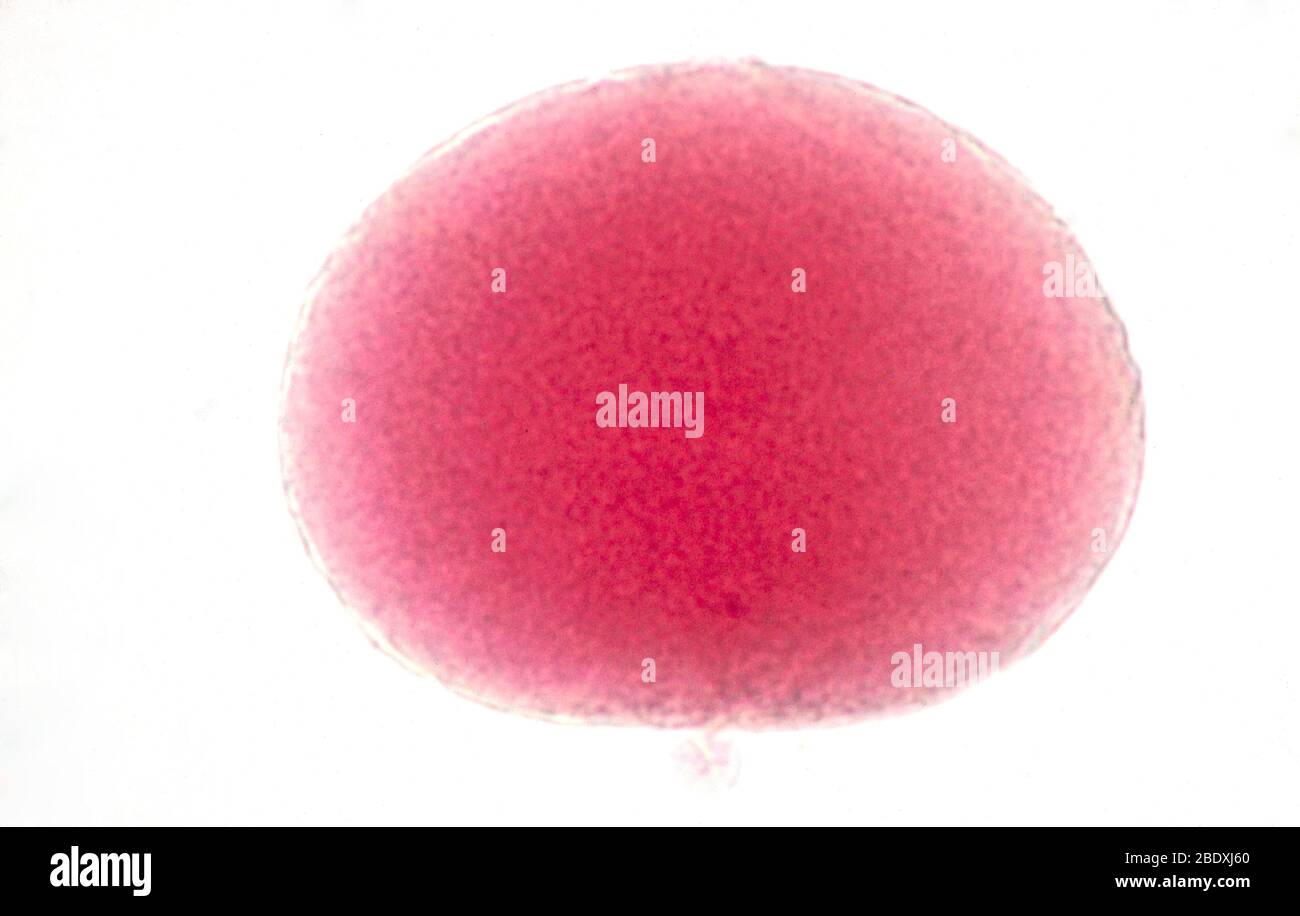 Seesterne Zygote und polaren Körper Stockfoto