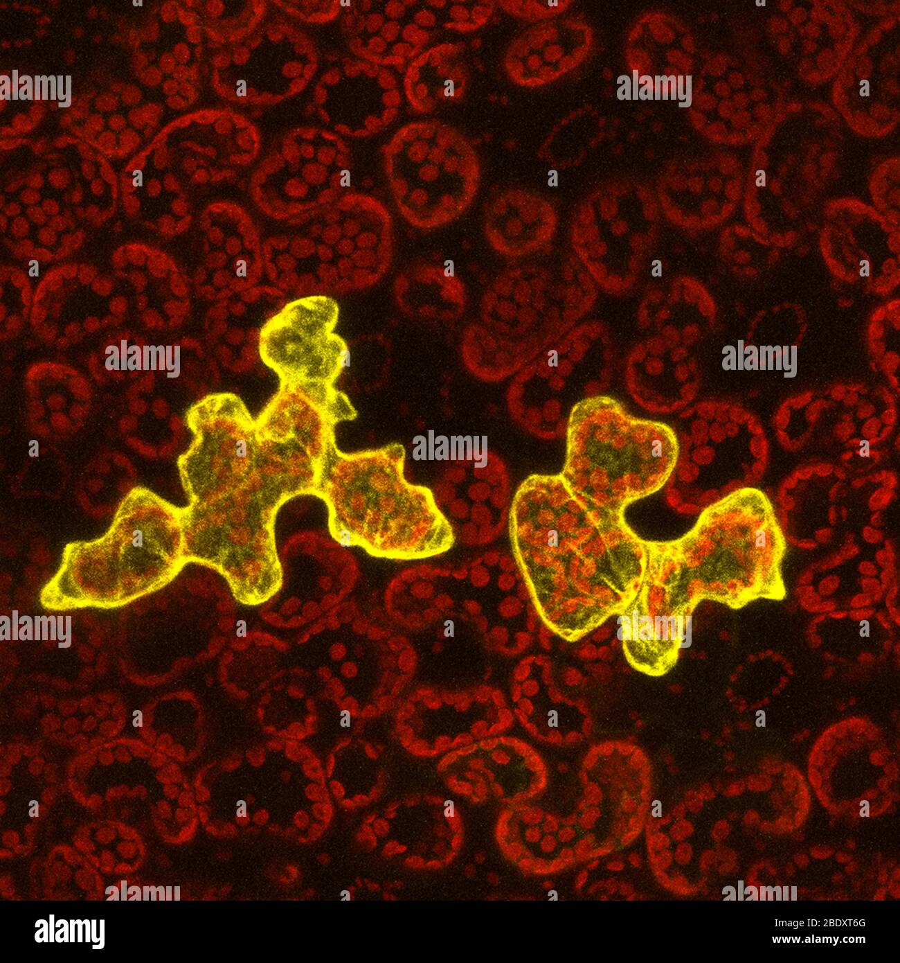 Pflanzen Sie epidermale Zellen mit viraler Infektion, Konfokaler Mikrograph Stockfoto