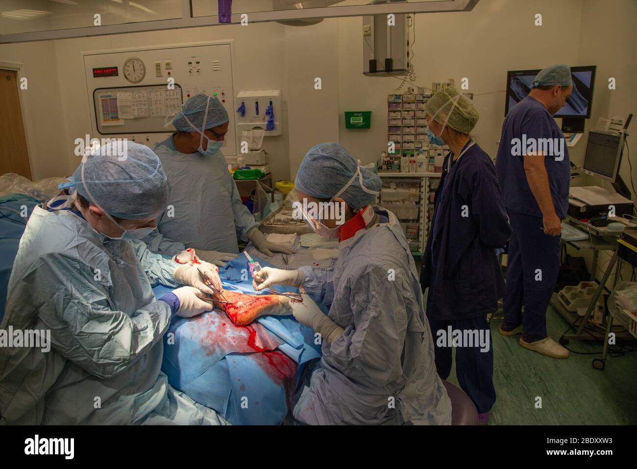 Chirurgen und Techniker führen eine Metallplatte in den Fußbereich des Fußes eines Patienten ein, um einen Knochenbruch und ein beschädigtes Gelenk zu reparieren. Stockfoto