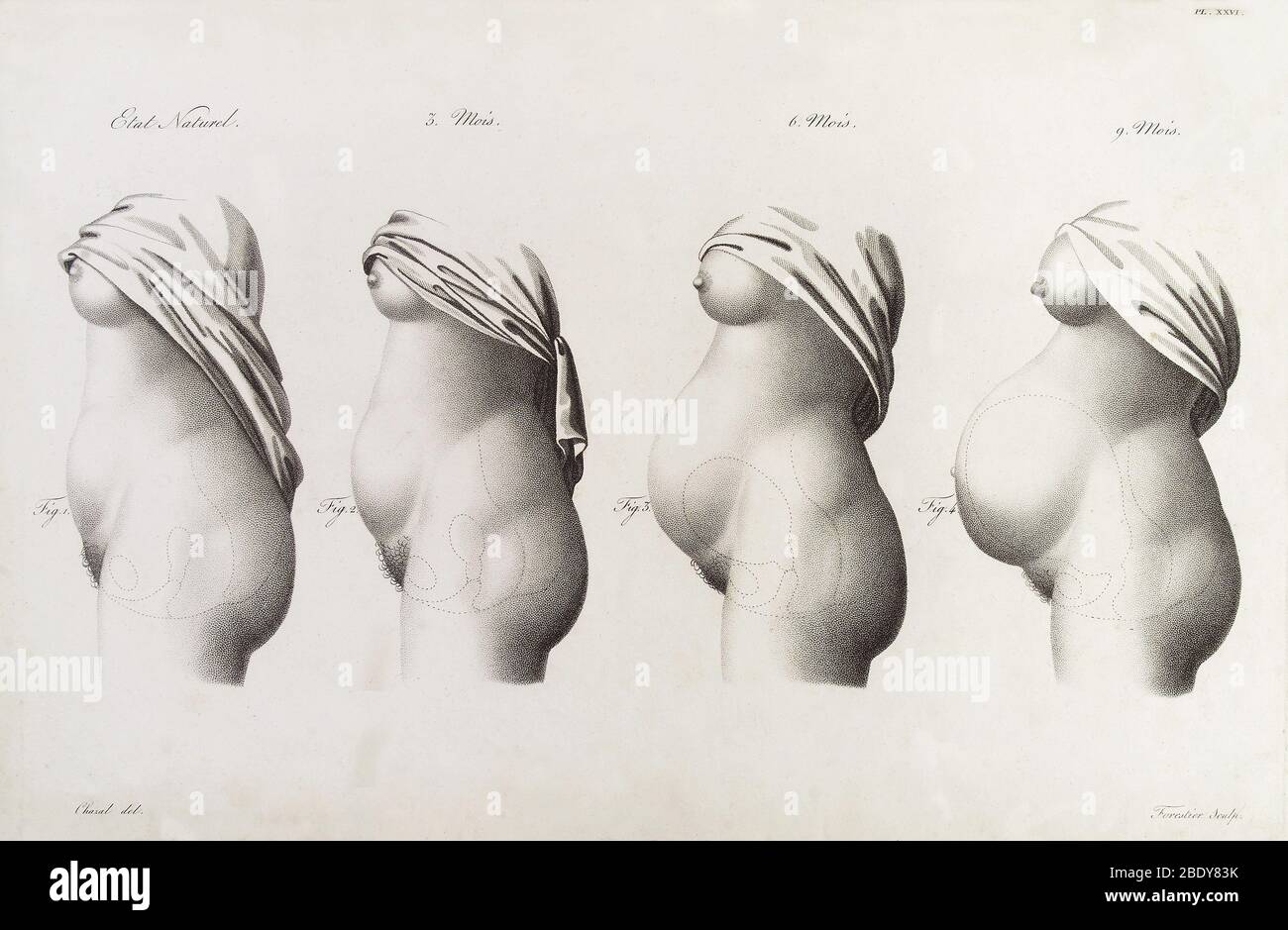 Schwangerschaft, Trimester, Illustration, 1822 Stockfoto