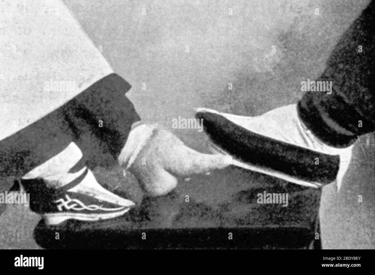 Gebunden im Vergleich zu normalem Fuß, China, 1899 Stockfoto