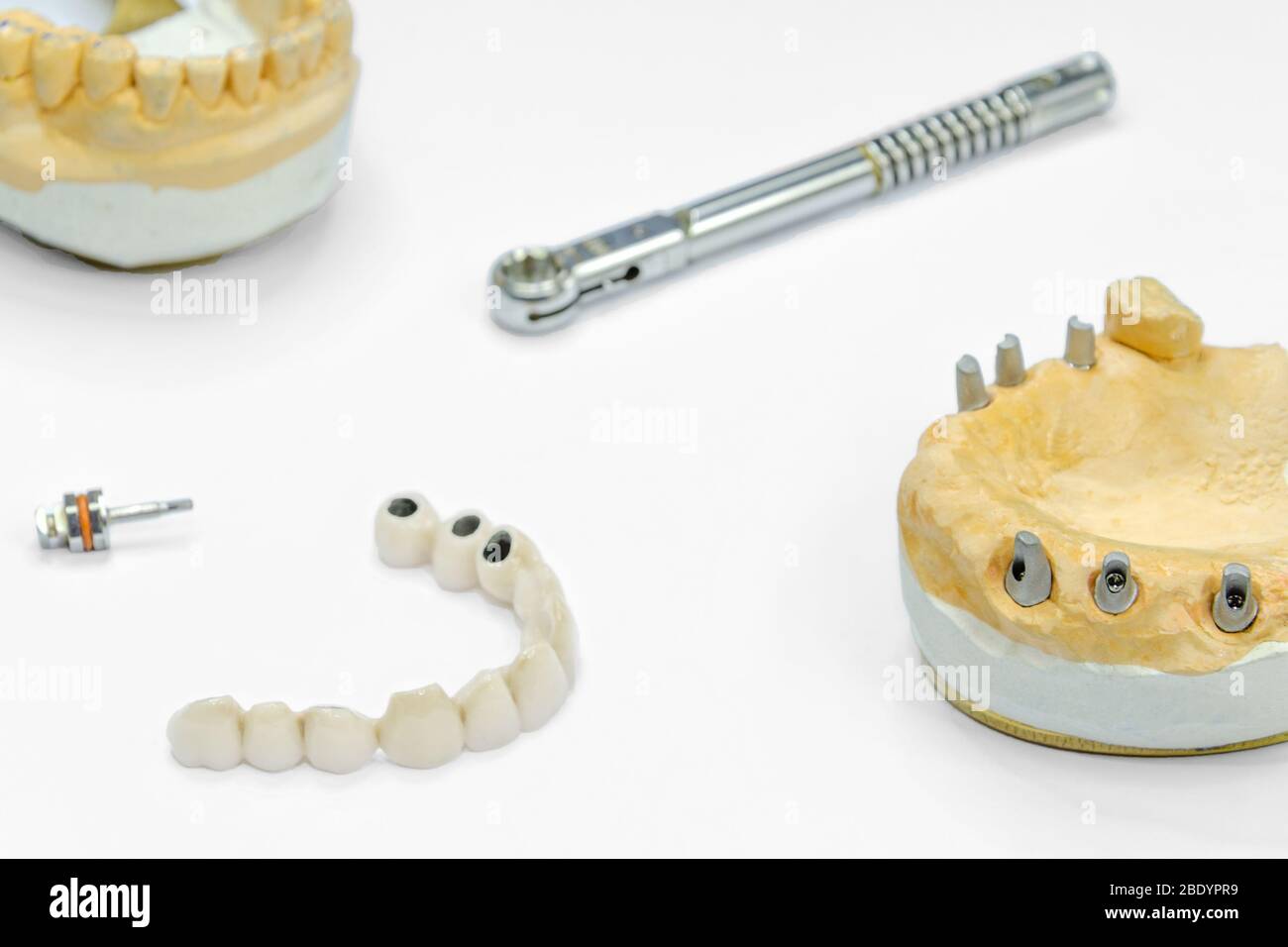 Der Prozess der Herstellung von keramischen Zähnen auf Implantaten. Zahnimplantate mit keramischen Zähnen auf einem hellen Hintergrund. Konzept der Zahnimplantation und d Stockfoto