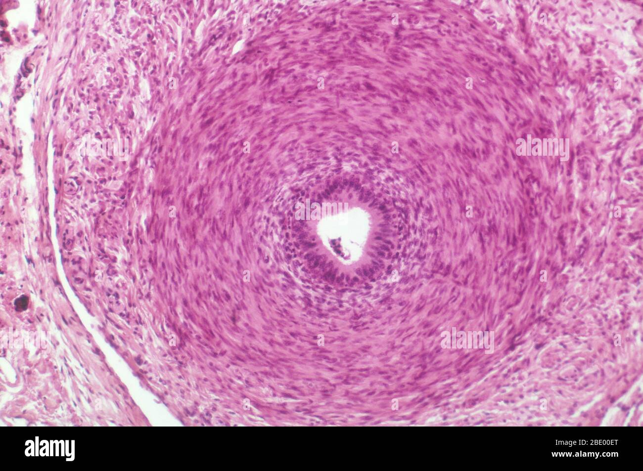 Vas Deferens Cat Stockfoto