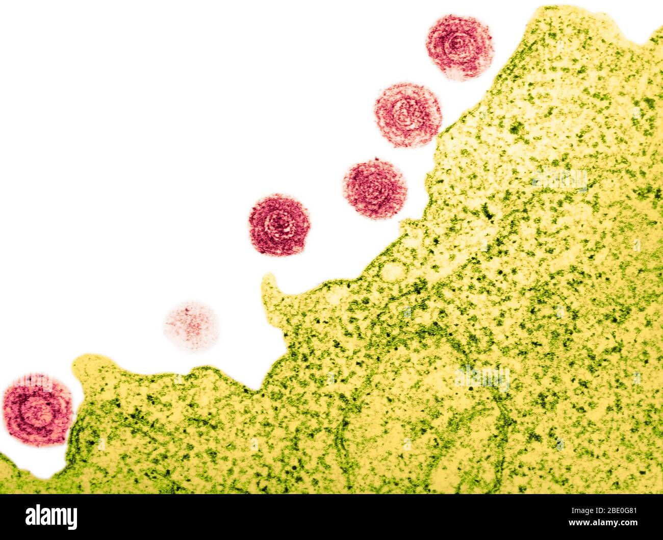 Farblich verstärkter Transmissionselektronenmikrograph (TEM) des HHV-6 (humanes Herpesvirus-6). Es wurde angenommen, dass es b-Zellen infizieren und wurde zu einer Zeit als HBLV, menschliches b-lymphotropes Virus. Es ist jetzt bekannt, T-Zellen als auch zu infizieren. Das HHV-6 ist ein doppelsträngiger DNA-Virus aus der Herpesfamilie. Die hier gezeigten Viruspartikel sind gereift und dann aus der angefallenen Lymphozyte freigesetzt. Das 'Eulenauge' der Viruspartikel ist charakteristisch für die Herpesfamilie. Stockfoto