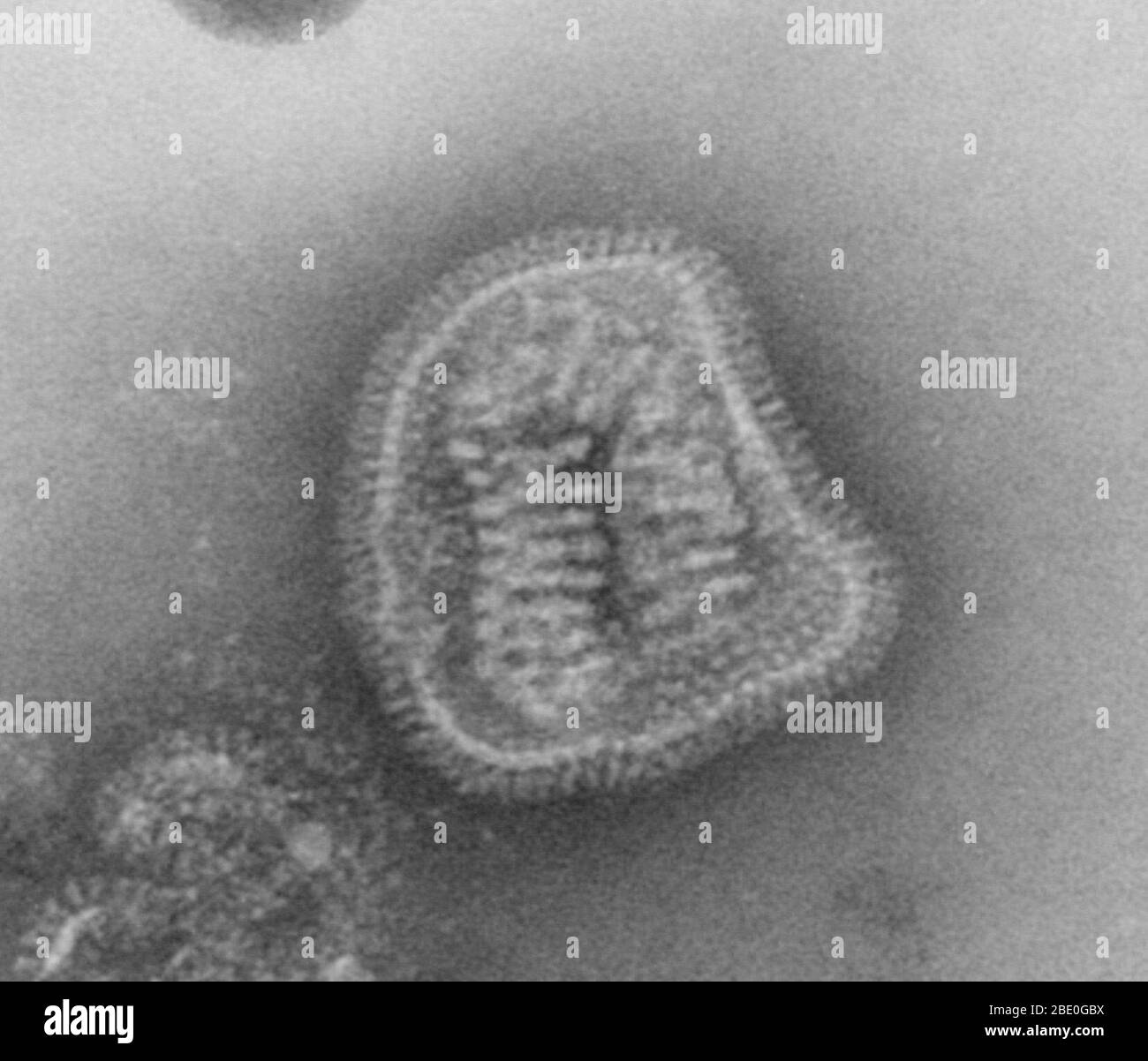 Negativ gefärbte Transmissions-Elektronenmikrographie (TEM) zeigt die ultrastrukturellen Details eines Influenza-Virus-Teilchens, oder "Virion". Das Grippevirus ist ein einsträngiger RNA-Organismus, der zur taxonomischen Familie Orthomyxoviridae gehört. Stockfoto