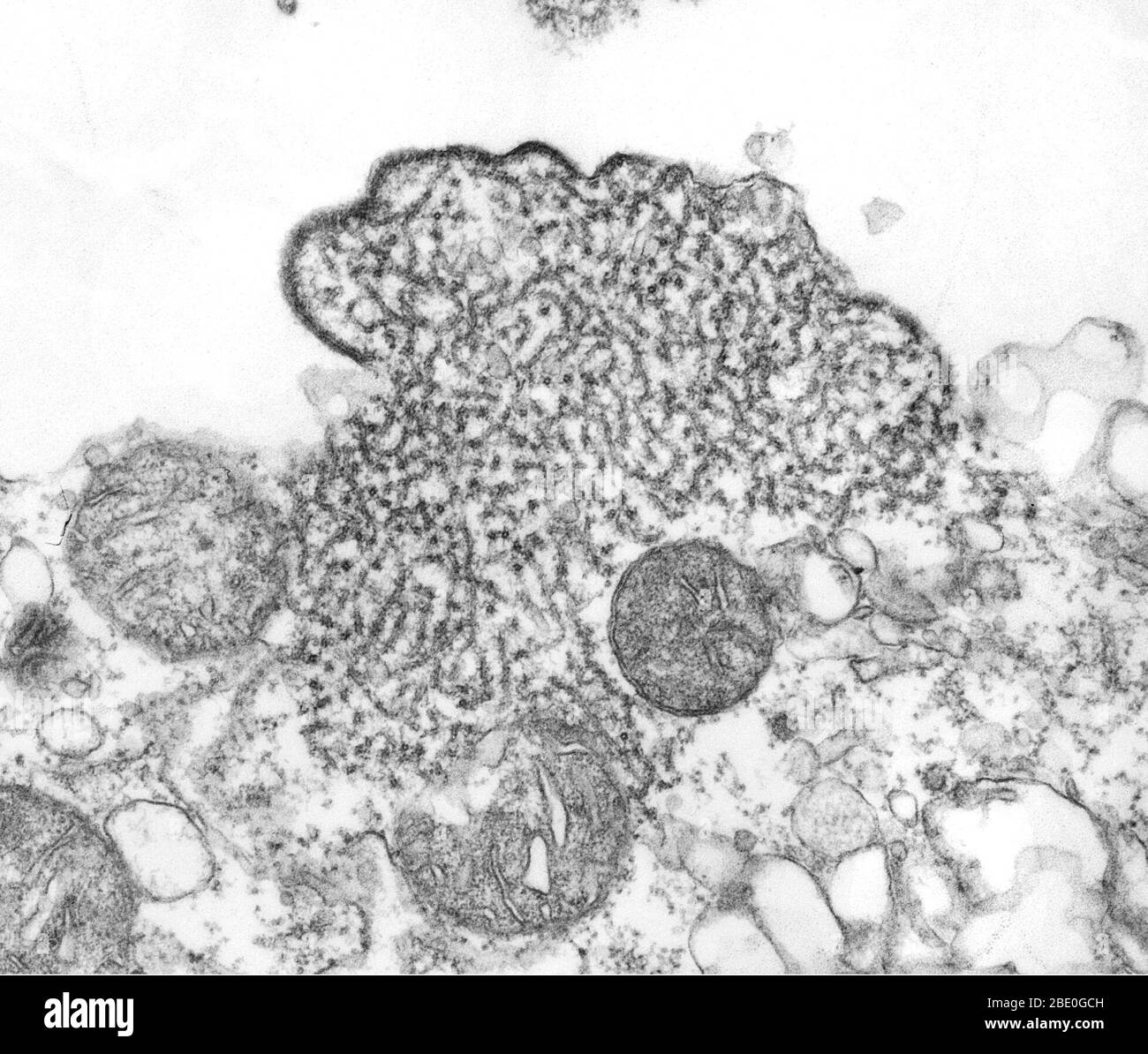 Transmission Electron Micrograph (TEM) zeigt eine Reihe von Nipah-Virus-Virionen, die aus einer Probe des Liquor (CSF) eines Patienten isoliert wurden. Nipah-Virus ist ein Mitglied der Familie Paramyxoviridae. Das Nipah-Virus wurde 1999 zunächst isoliert, nachdem Proben eines Ausbruchs von Enzephalitis und Atemwegserkrankungen bei erwachsenen Männern in Malaysia und Singapur untersucht wurden. Eine Infektion mit dem Nipah-Virus war mit einer Enzephalitis assoziiert, die durch Fieber und Schläfrigkeit und schwerwiegendere Erkrankungen des Zentralnervensystems wie Koma, Krampfanfälle und Atemnot gekennzeichnet war. Krankheit mit Stockfoto