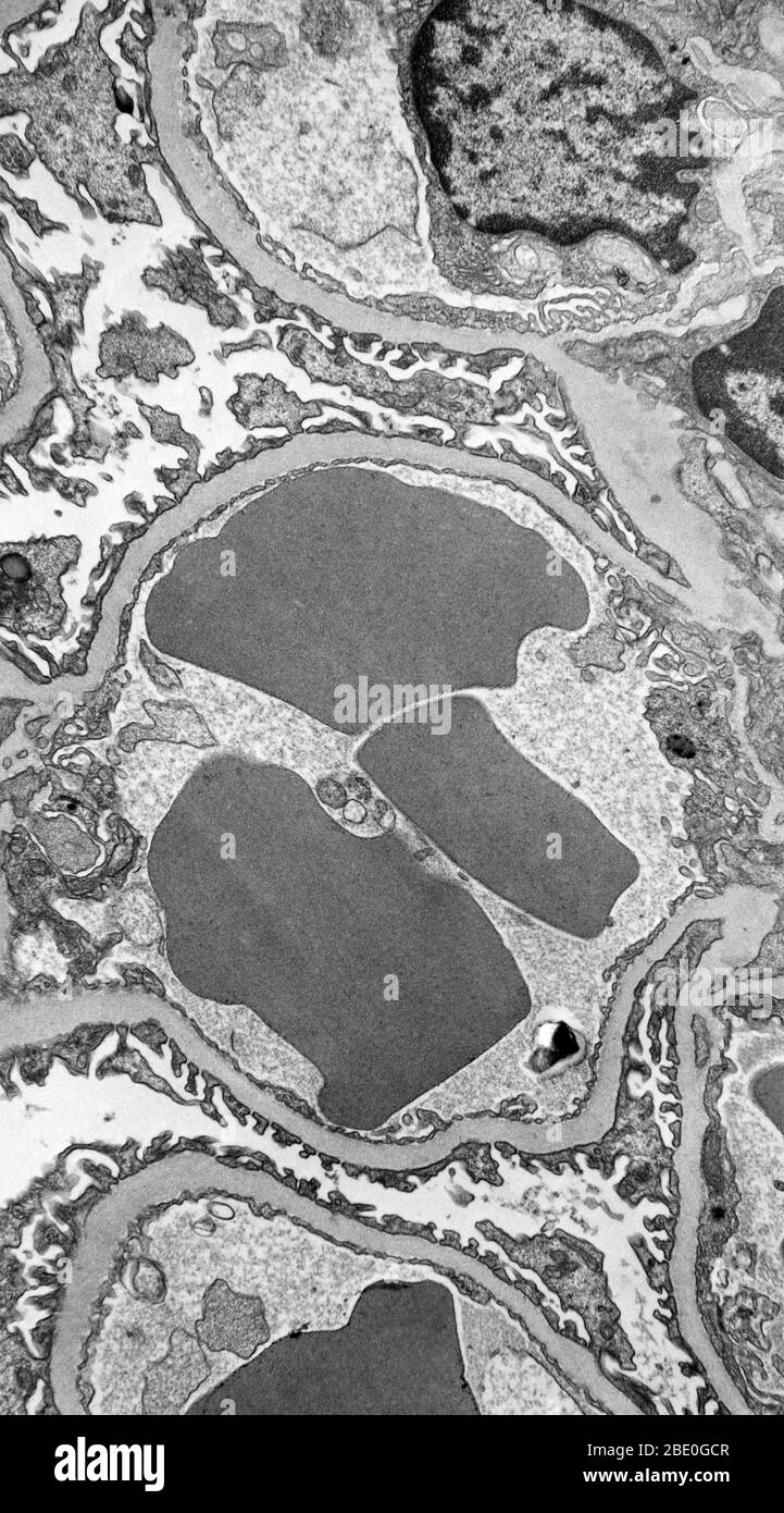 TEM mehrerer roter Zellen im Querschnitt innerhalb der Kapillarschleife (eines der kleinen Blutgefäße, die Blut in den Papillen der Haut tragen) eines Glomerulus aus der Niere einer Maus. Die hämoglobinhaltigen roten Zellen erscheinen tief grau und homogen, da sie keine Kerne enthalten. Das Blut in der Kapillarschleife filtert Materialien über die dünnen zellulären Prozesse des Endothels (die graue amorphe Basalmembran, die die Zellen umgibt) und zwischen den Fußprozessen der spezialisierten Zellen (Podocyten), die den Harnraum aussäumen. Vergrößerung: 14.000. Stockfoto