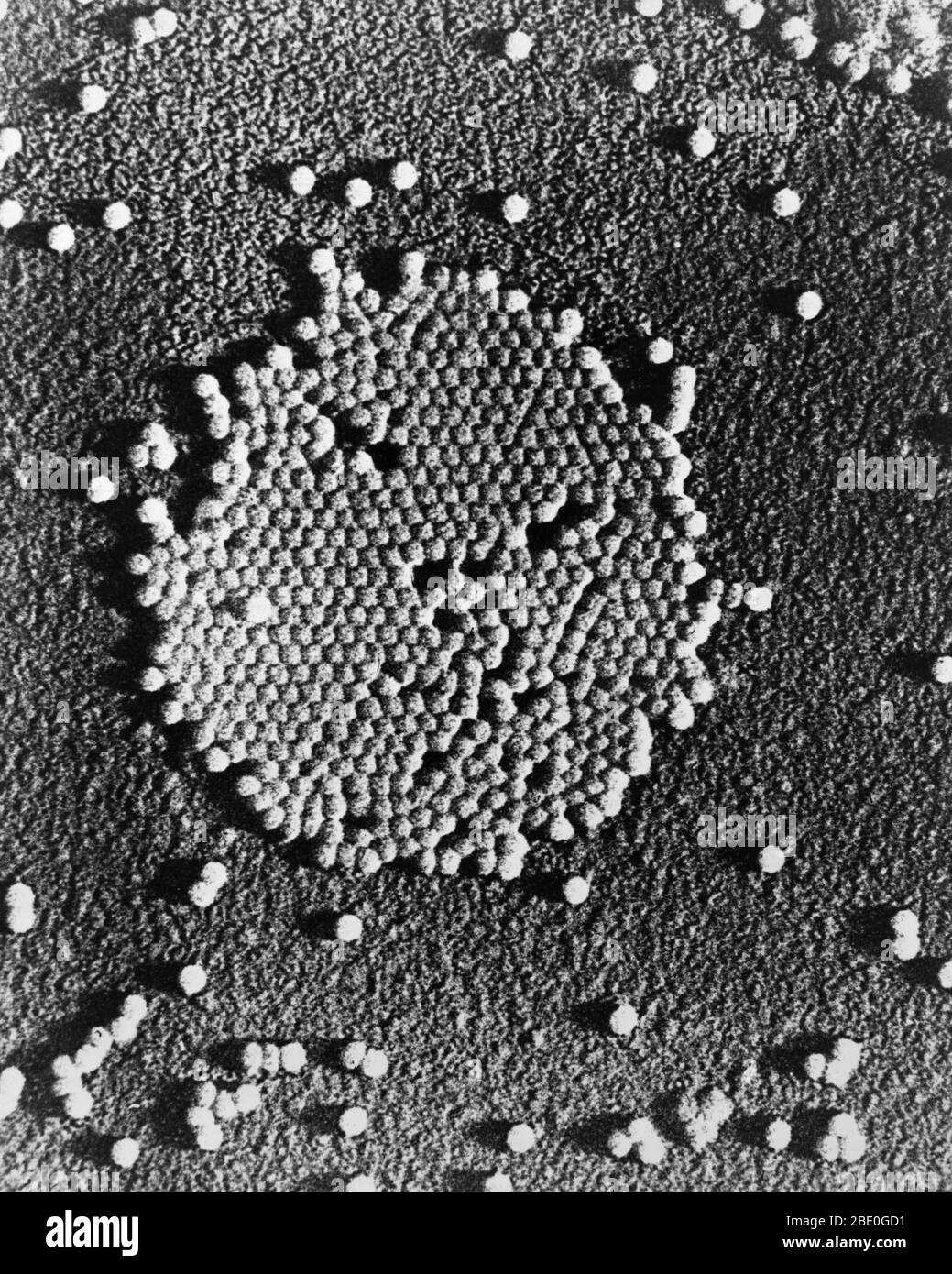 Transmission Electron Micrograph (TEM) des Poliovirus. Poliovirus, der Erreger der Poliomyelitis (auch Polio genannt), ist ein menschliches Enterovirus und Mitglied der Familie der Picornaviridae. Poliovirus besteht aus einem RNA-Genom und einem Protein-Capsid. Poliovirus ist ein positiv-gestrandetes RNA-Virus. Poliovirus ist strukturell ähnlich zu anderen menschlichen Enteroviren (Coxsackievirus, Echoviren und Rhinoviren), die auch immunoglovulinähnliche Moleküle verwenden, um Wirtszellen zu erkennen und in sie einzudringen. Das Poliovirus wurde 1909 von Karl Landsteiner und Erwin Popper isoliert. Im Jahr 1981 wurde das Poliovirus g Stockfoto
