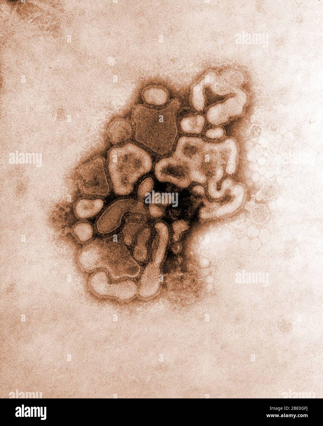 Kolorierte Transmissionselektronenmikrographie (TEM) des A/New Jersey/76 (Hsw1N1)-Virus, während der erste Entwicklungsgang des Virus durch ein Hühnereier erfolgt. Schweinegrippe ist eine Atemwegserkrankung von Schweinen, die durch eine Grippe vom Typ A verursacht wird und regelmäßig zu einem Grippeausbruch bei Schweinen führt. Schweinegrippe-Viren verursachen hohe Krankheitswerte und niedrige Todesraten bei Schweinen. Schweinegrippeviren können in den Schweinen das ganze Jahr über zirkulieren, aber die meisten Ausbrüche unter den Schweinehüchsen treten während der späten Herbst- und Wintermonate auf, ähnlich wie bei Menschen. Das klassische Schweinegrippe-Virus (ein Influenza-Typ Stockfoto