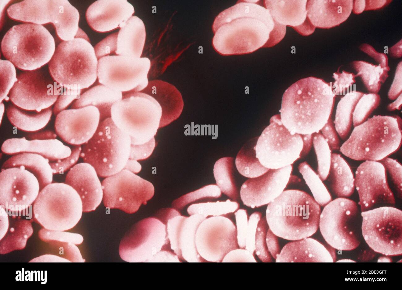 Farbige Rasterelektronenmikrograph (SEM) von menschlichen roten Blutkörperchen (Erythrozyten). Rote Blutkörperchen sind Biconcave, die ihnen eine große Oberfläche für den Gasaustausch und hoch elastisch, so dass sie durch schmale Kapillargefäße passieren. Der Kern und andere Organellen gehen mit der Zellreife verloren. Das Innere der Zelle ist mit Hämoglobin, einem roten Eisen-haltigen Pigment, das eine Sauerstofftragfähigkeit hat, verpackt. Die Hauptfunktion der roten Blutkörperchen ist es, Sauerstoff an Körpergewebe zu verteilen und den Abfall Kohlendioxid zurück in die Lunge zu tragen. Stockfoto