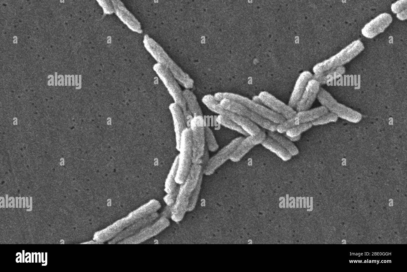 Rasterelektronenmikrograph SEM) einer Reihe einer großen Gruppe von gramnegativen Legionella pneumophila-Bakterien. Beachten Sie die Anwesenheit von polaren Geißeln und Pili, oder lange Streamer. Eine Reihe dieser Bakterien scheinen eine längliche Stäbchen Morphologie zeigen. L. pneumophila sind bekannt, dass diese Konfiguration am häufigsten zeigen, wenn sie in Brühe gewachsen sind, aber sie können auch verlängern, wenn Platte-gewachsene Zellen altern, wie es in diesem Fall war, vor allem, wenn sie gekühlt wurden. Die übliche L. pneumophila-Morphologie besteht aus stout, 'fetten' Bazillen, was bei der überwiegenden Mehrheit der Organismen der Fall ist Stockfoto