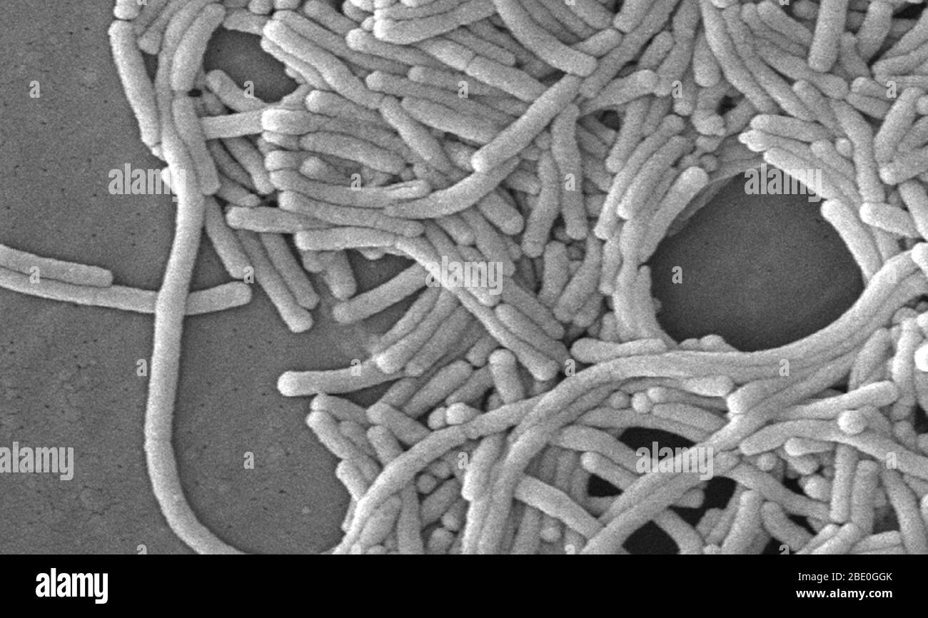 Rasterelektronenmikrograph (SEM) einer Reihe einer großen Gruppe von gramnegativen Legionella pneumophila-Bakterien. Beachten Sie die Anwesenheit von polaren Geißeln und Pili, oder lange Streamer. Eine Reihe dieser Bakterien scheinen eine längliche Stäbchen Morphologie zeigen. L. pneumophila sind bekannt, dass diese Konfiguration am häufigsten zeigen, wenn sie in Brühe gewachsen sind, aber sie können auch verlängern, wenn Platte-gewachsene Zellen altern, wie es in diesem Fall war, vor allem, wenn sie gekühlt wurden. Die übliche L. pneumophila-Morphologie besteht aus stout, 'fetten' Bazillen, was bei der überwiegenden Mehrheit der Organismen der Fall ist Stockfoto