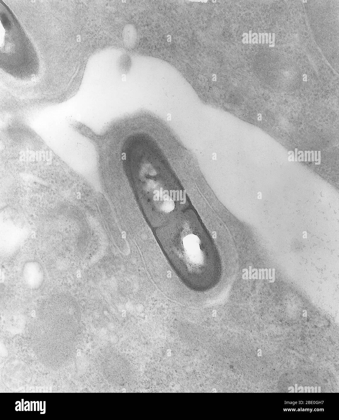 Transmission Electron Micrograph (TEM) eines Listeria Bakteriums im Gewebe. Listeria ist eine Bakteriengattung, die bis 1992 10 bekannte Arten enthielt, die jeweils zwei Unterarten enthielten. Ab 2014 wurden weitere fünf Arten identifiziert. Benannt nach dem britischen Pionier der sterilen Chirurgie Joseph Lister, erhielt die Gattung ihren heutigen Namen im Jahr 1940. Listeria-Arten sind gram-positiv, stäbchenförmig und fakultativ anaerob und produzieren keine Endosporen. Der wichtigste Erreger der Gattung Listeria ist L. monocytogenes. Es ist in der Regel der Erreger der relativ seltenen bakteriellen Krankheitsliste Stockfoto