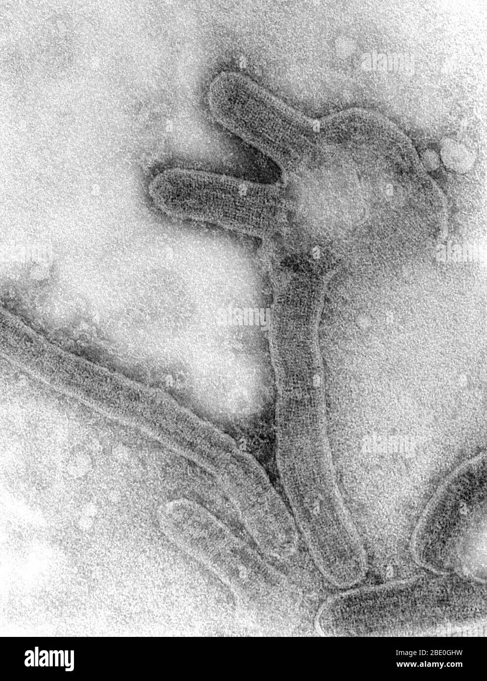 Dieser negativ gefärbte Transmissionselektronenmikrograph (TEM) zeigt eine Reihe von Marburger Virionen, die in einer Umgebung von Gewebekulturzellen gewachsen waren. Marburger Hämorrhagisches Fieber ist eine seltene, schwere Art von hämorrhagischem Fieber, das sowohl Menschen als auch nicht-menschliche Primaten betrifft. Durch ein genetisch einzigartiges zoonotisches (d.h. tierisches) RNA-Virus der Filovirus-Familie verursacht, führte seine Anerkennung zur Entstehung dieser Virusfamilie. Die vier Arten des Ebola-Virus sind die einzigen anderen bekannten Mitglieder der Familie des Filovirus. Nach einer Inkubationszeit von 5-10 Tagen tritt die Krankheit auf Stockfoto