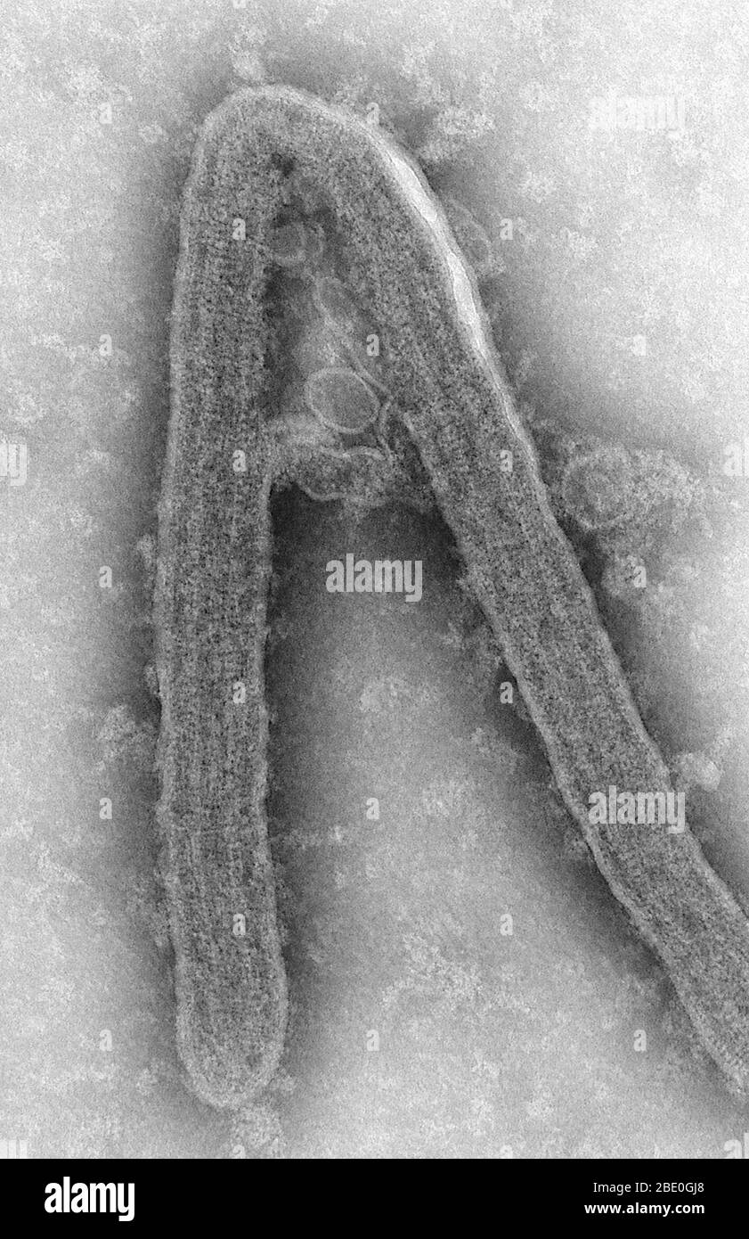 Negativ gefärbte Transmissionselektronenmikrographie (TEM) zeigt ein Marburger Virion, das in einer Umgebung von Gewebekulturzellen gewachsen war. Marburger Hämorrhagisches Fieber ist eine seltene, schwere Art von hämorrhagischem Fieber, das sowohl Menschen als auch nicht-menschliche Primaten betrifft. Verursacht durch ein genetisch einzigartiges zoonotisches RNA-Virus der Filovirus-Familie, führte seine Anerkennung zur Schaffung dieser Virusfamilie. Nach einer Inkubationszeit von 5-10 Tagen tritt die Krankheit plötzlich auf und ist von Fieber, Schüttelfrost, Kopfschmerzen und Myalgie gekennzeichnet. Übelkeit, Erbrechen, Brustschmerzen, Halsschmerzen, Bauchschmerzen und Stockfoto