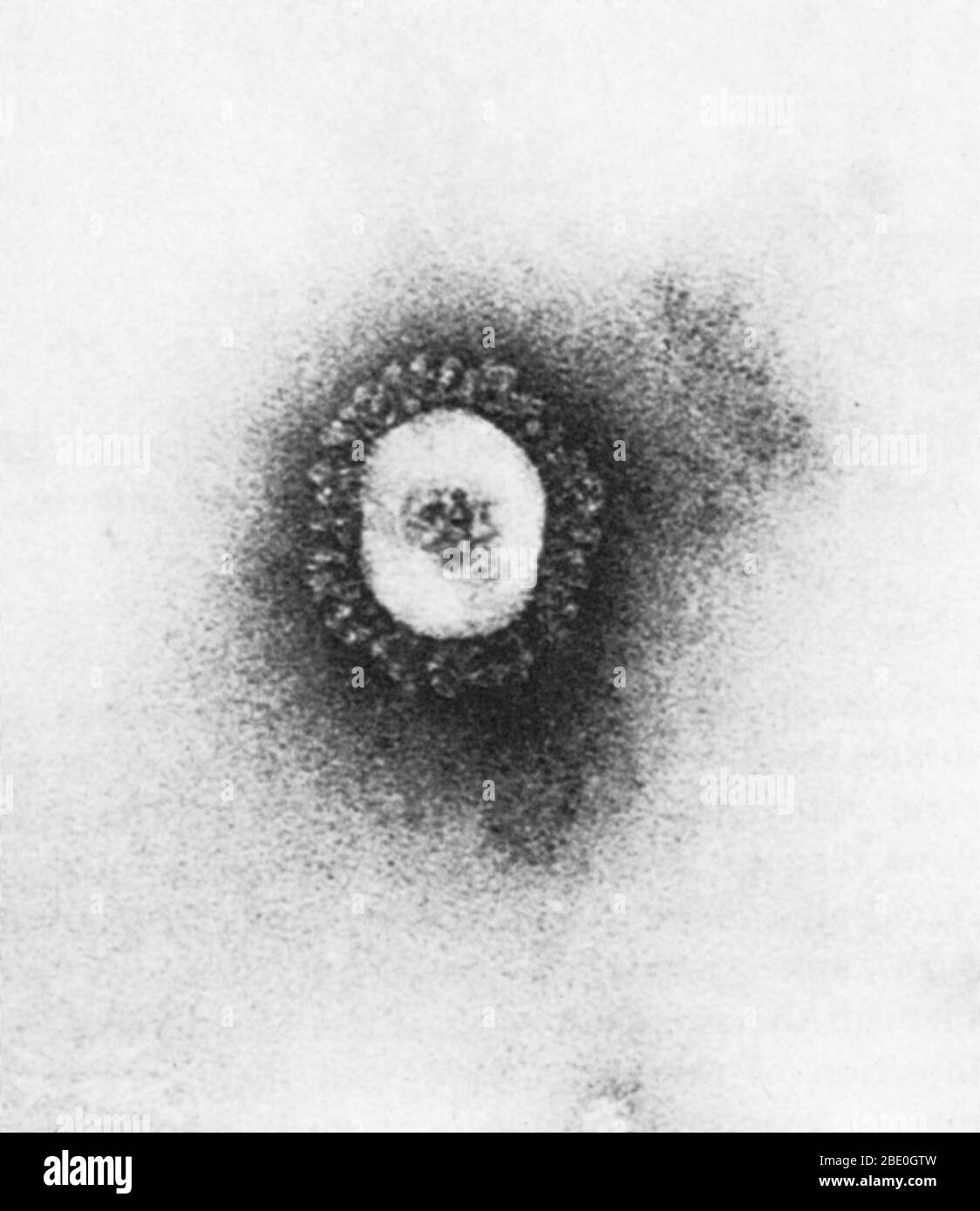Transmissionselektronenmikrograph (TEM) eines Coronavirus, der die Erkältung verursacht. Coronaviren sind Arten von Viren, die zur Unterfamilie Coronavirinae in der Familie Coronaviridae, in der Reihenfolge Nidovirales gehören. Coronaviren sind eingehüllte Viren mit einem positiv-Sinn-Single-strängten RNA-Genom und mit einem Nukleokapsid von helikaler Symmetrie. Die genomische Größe von Coronaviren reicht von etwa 26 bis 32 Kilobasen, die größte für ein RNA-Virus. Stockfoto