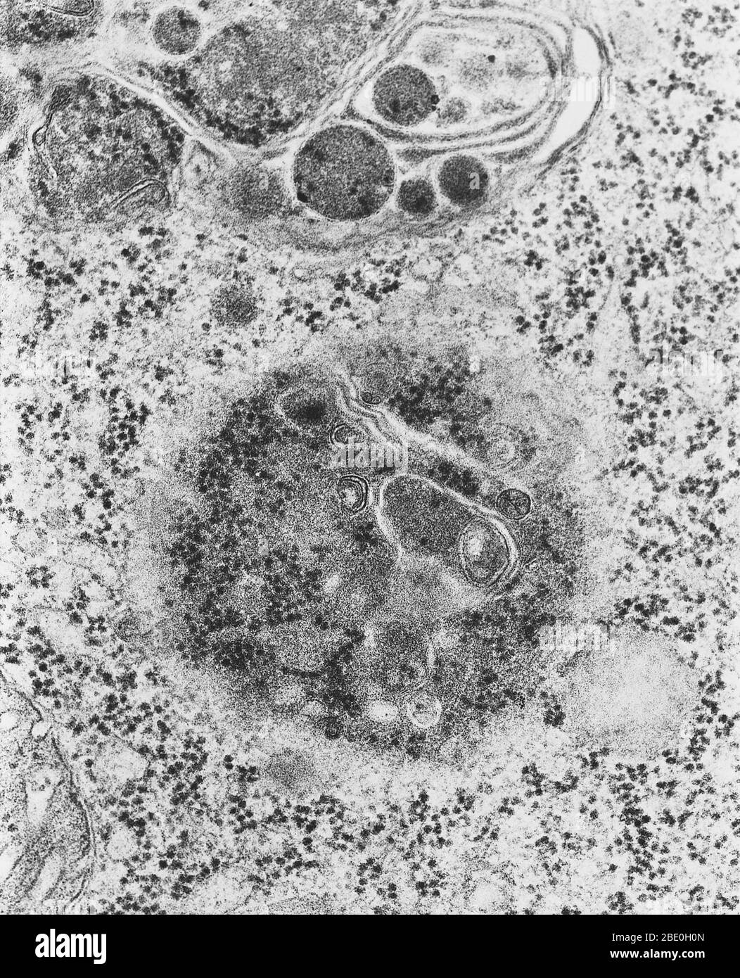 Transmissionselektronenmikrograph (TEM) von Lysosomen. Ein Lysosososososum  ist ein membrangebundenes Organell, das in fast allen tierischen Zellen  gefunden wird. Es sind kugelförmige Vesikel, die hydrolytische Enzyme  enthalten, die praktisch alle Arten ...