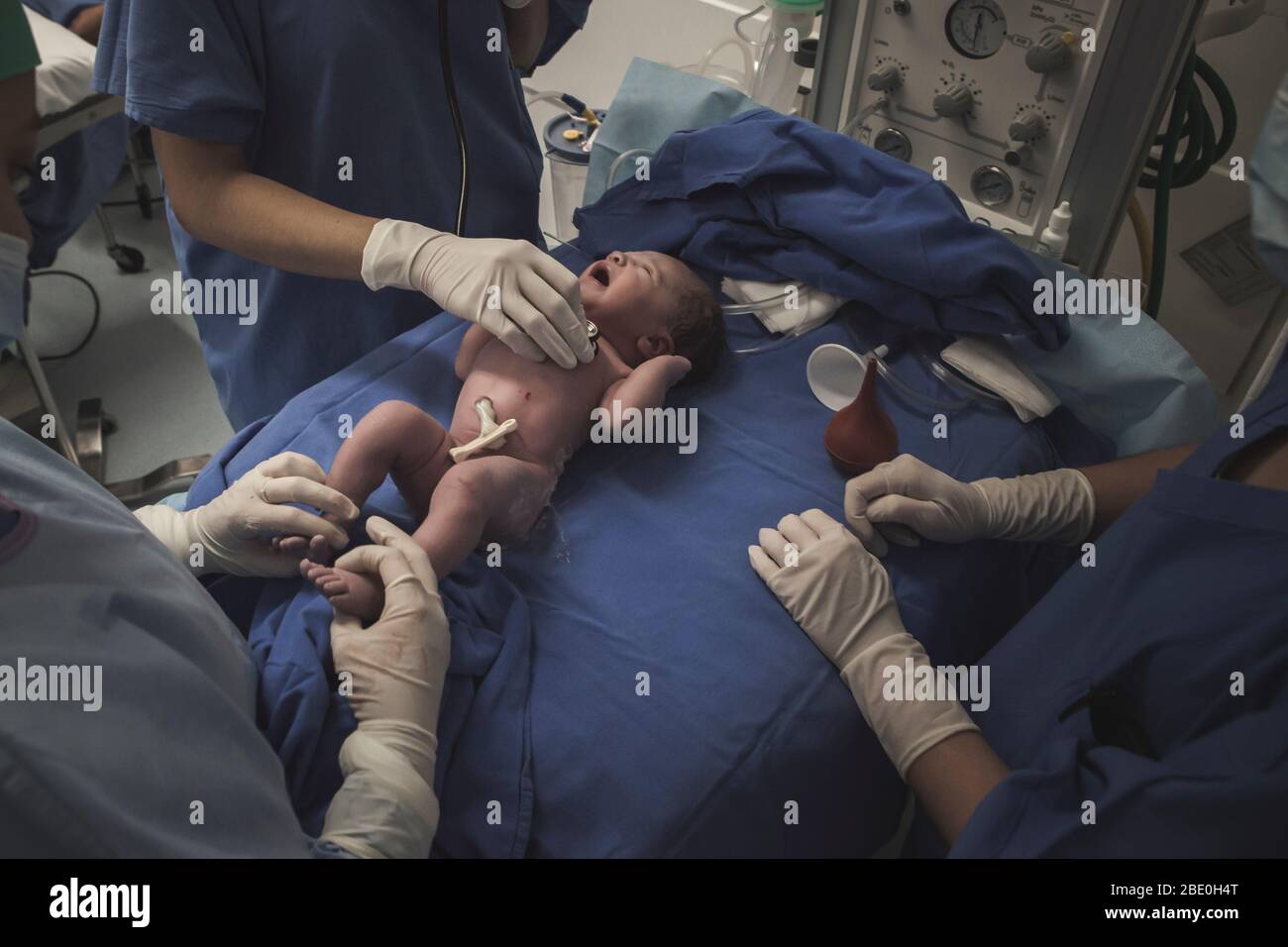 Erster Moment eines Neugeborenen, Wehen in einem Krankenhaus. Nach der Geburt. Stockfoto