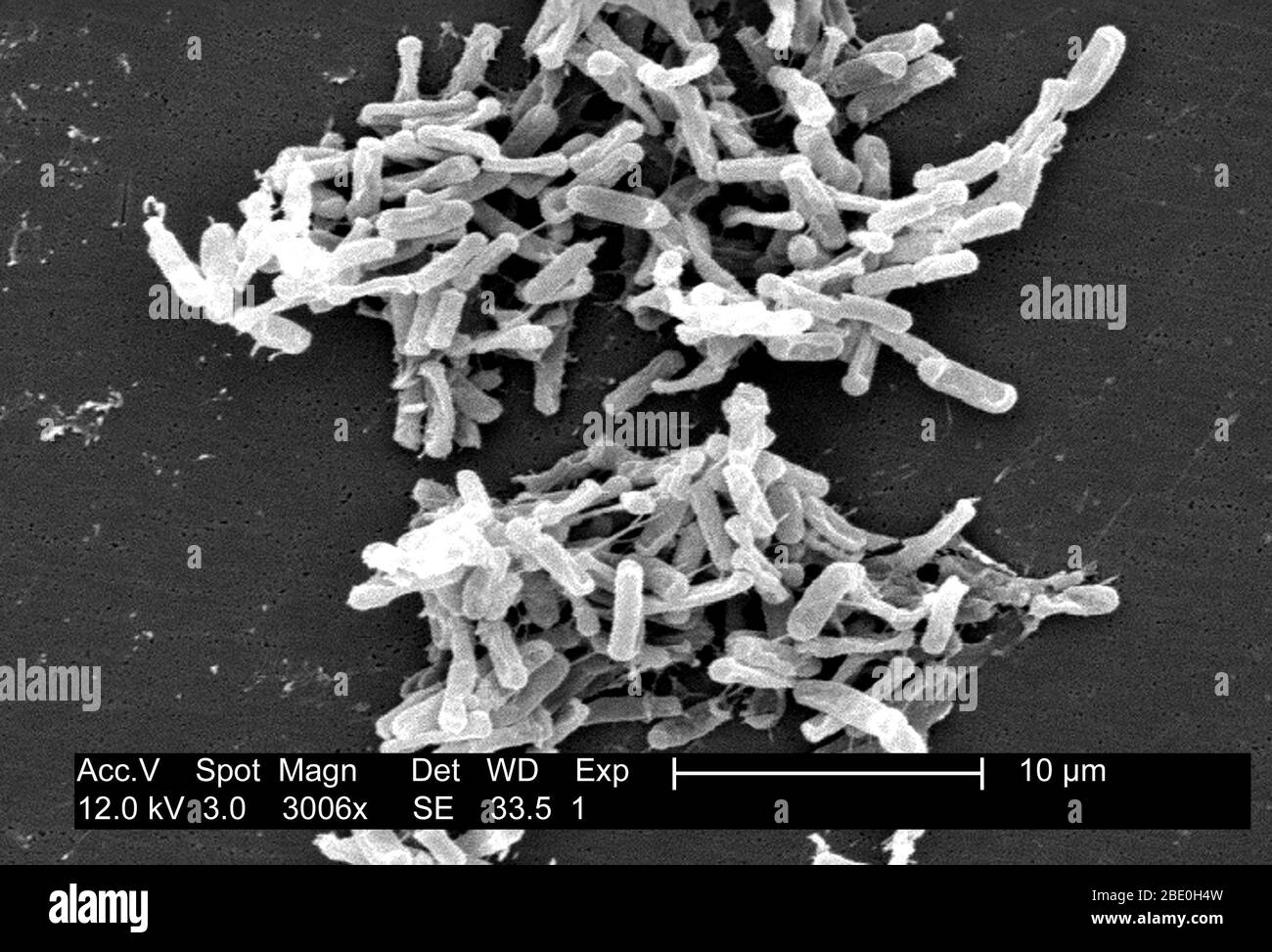 Scanning Electron Micrograph (SEM) zeigt Gram-positive Clostridium difficile Bakterien. Diese C. difficile-Organismen wurden aus einer Stuhlprobe kultiviert, die bei einem Ausbruch einer Magen-Darm-Erkrankung gewonnen wurde, und mit einem .1µm-Filter extrahiert. C. difficile verursacht Durchfall und ernstere Darmerkrankungen wie Kolitis. Stockfoto