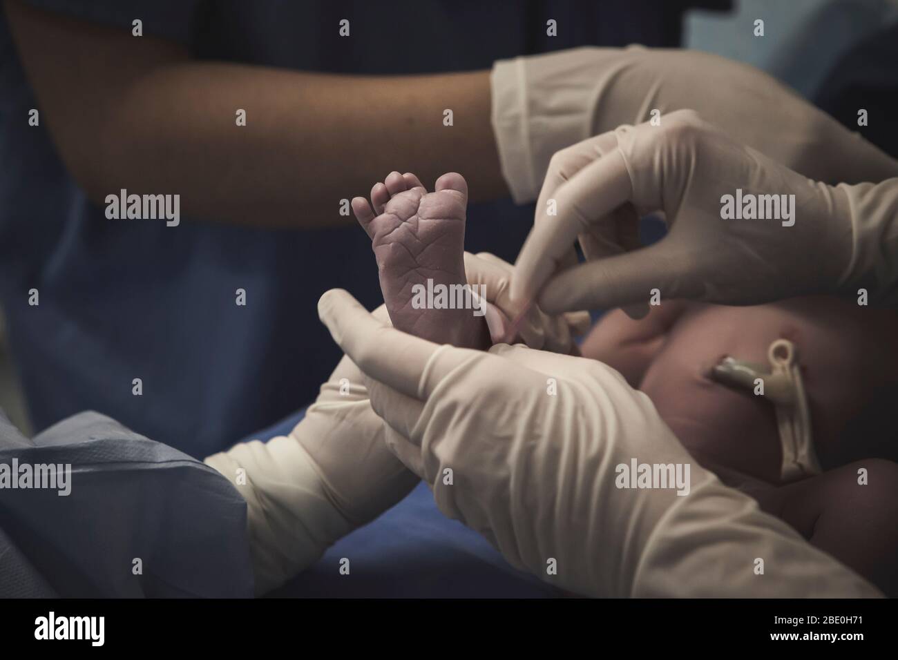 Erster Moment eines Neugeborenen, Wehen in einem Krankenhaus. Nach der Geburt. Stockfoto