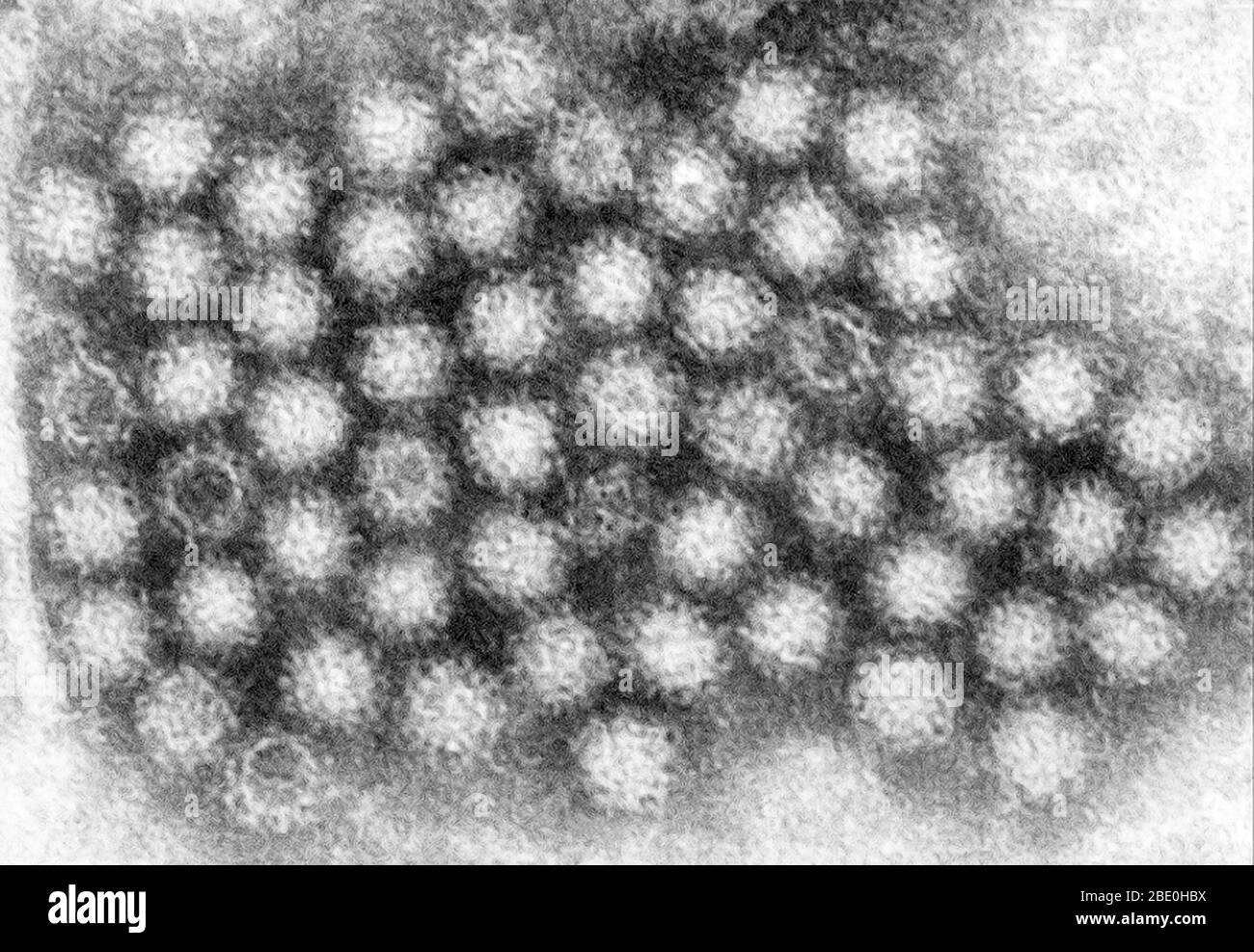 Dieser Transmissionselektronenmikrograph (TEM) zeigte einige der ultrastrukturellen Morphologie, die von Norovirus-Virionen oder Viruspartikeln dargestellt wurde. Noroviren gehören zur Gattung Norovirus und zur Familie Caliciviridae. Sie sind eine Gruppe von verwandten, einsträngigen RNA, unbehüllten Viren, die akute Gastroenteritis beim Menschen verursachen. Norovirus wurde kürzlich als offizieller Genus-Name für die Gruppe der Viren zugelassen, die vorläufig als Norwalk-like Virus (NLV) beschrieben werden. Stockfoto