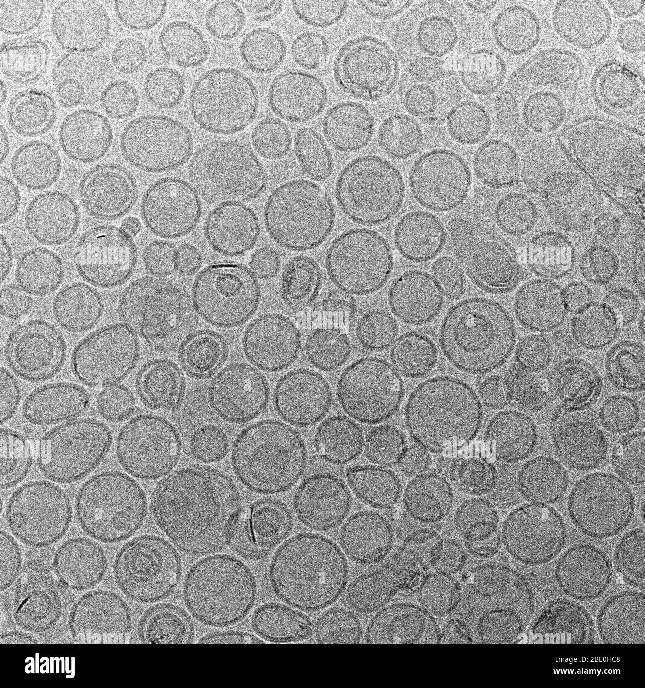 Kryo-EM-Bild von Liposomen, künstlich präparierten Vesikeln, die aus einer Lipiddoppelschicht bestehen. Sie können als Träger für die Verabreichung von Nährstoffen oder Arzneimitteln verwendet werden. Vergrößerung unbekannt. Stockfoto