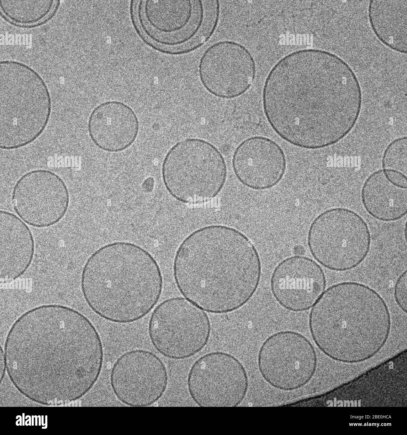 Kryo-EM-Bild von Bolalipid-Liposomen, künstlich präparierten Vesikeln, die aus einer Lipid-Doppelschicht bestehen. Sie können als Träger für die Verabreichung von Nährstoffen oder Arzneimitteln verwendet werden. Vergrößerung unbekannt. Stockfoto