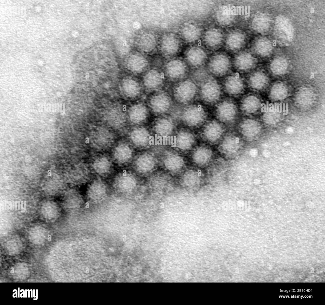 Dieser Transmissionselektronenmikrograph (TEM) zeigte einige der ultrastrukturellen Morphologie, die von Norovirus-Virionen oder Viruspartikeln dargestellt wurde. Noroviren gehören zur Gattung Norovirus und zur Familie Caliciviridae. Sie sind eine Gruppe von verwandten, einsträngigen RNA, unbehüllten Viren, die akute Gastroenteritis beim Menschen verursachen. Norovirus wurde kürzlich als offizieller Genus-Name für die Gruppe der Viren zugelassen, die vorläufig als Norwalk-like Virus (NLV) beschrieben werden. Stockfoto