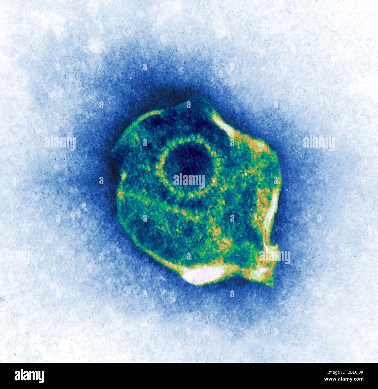 Farblich verbesserte Transmissionselektronenmikrographie (TEM) des Herpes Simplex Virus. Stockfoto