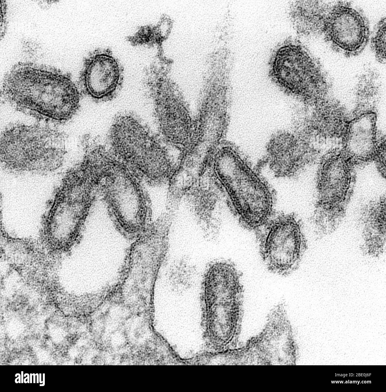 TEM einer ultradünnen Probe zeigte einige der ultrastrukturellen morphologischen Merkmale, die bei 1918 Grippevirionen beobachtet wurden. Die prominenten Oberflächenprojektionen auf den Virionen bestehen entweder aus dem Hämagglutinin oder aus der Neuraminidase-Art von Glykoproteinen. Zusammengesetzt aus, was aussah wie Punkte oder Tubuli, war eine dichte Hülle bekannt als Capsid, die jedes Virion Nukleinsäure Bestandteile umgeben. Die Grippe ist eine ansteckende Atemwegserkrankung, die durch Influenzaviren verursacht wird. Es kann leichte bis schwere Krankheit verursachen und manchmal zum Tod führen. Vergrößerung unbekannt. Stockfoto