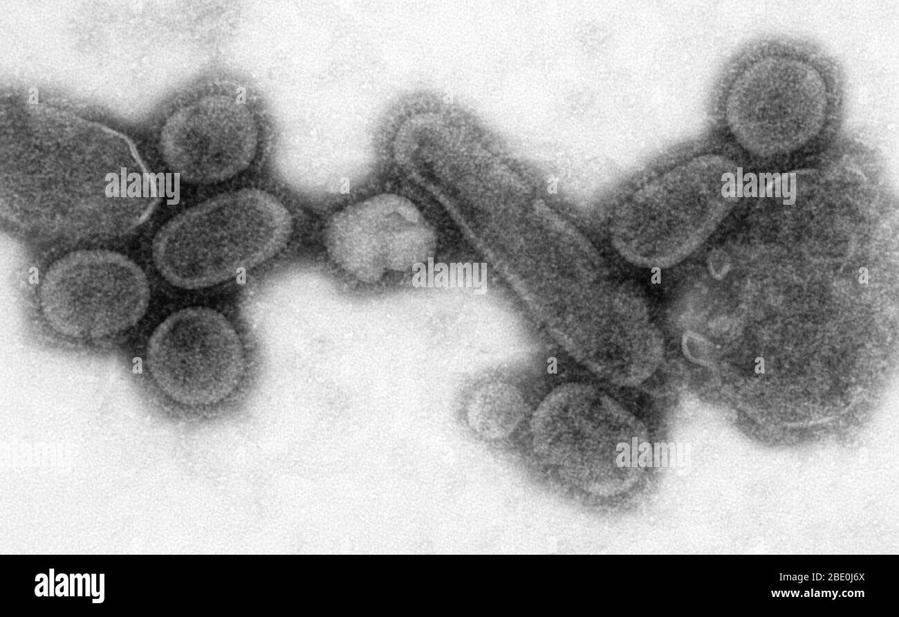 Negativ gefärbte TEM zeigt nachgebildete 1918 Influenza-Virionen, die 1918 Stunden nach der Infektion aus dem Überstand einer 18-infizierten Madin-Darby-Nierenzellkultur der Hunde entnommen wurden. Dr.Terrence Tumpey, Mikrobiologe und Mitglied des NCID, hat das Influenza-Virus 1918 nachgebildet, um die Eigenschaften zu identifizieren, die diesen Organismus zu einem tödlichen Erreger machten. Forschungsbemühungen wie diese ermöglichen es Forschern, neue Impfstoffe und Behandlungen für zukünftige Grippeviren zu entwickeln. Vergrößerung unbekannt. Stockfoto