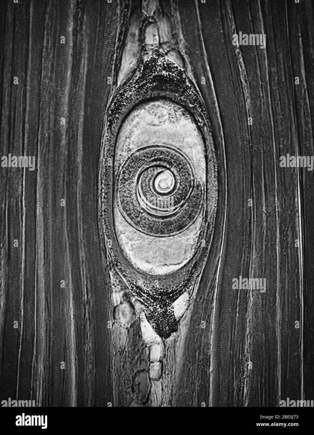 Leichte Mikrographie des Muskels mit eingezäuntem Trichinella spiralis, einem Fadenwurm-Parasiten, der für die Trichinose-Krankheit verantwortlich ist. Vergrößerung: 300FACH. Stockfoto