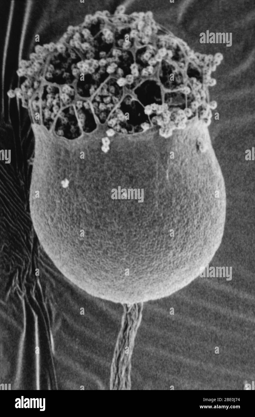Scannen Electron-Mikrograph von Cribraria minutissima Schleim Form. Diese Familie hat einen ausgeprägten gestielten Fruchtkörper mit einem Netz oder gerippten Abdeckung über der Sporenmasse. Stockfoto