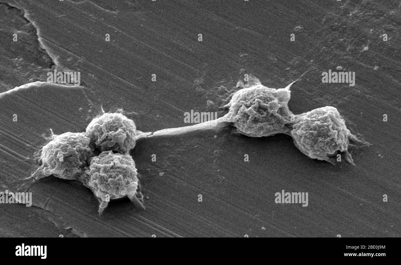 Freilebende Amöben (FLA) in der Amöbozoa-Gruppe sind wichtige Krankheitsursachen bei Mensch und Tier. Rasterelektronenmikrographie (SEM) eines im Labor angebauten trinkbaren (Trink-)Wasser-Biofilms mit der Anwesenheit von Vermamoeba vermiformis (Hartmanella) Zysten. Wasserbakterien wurden eine Woche lang als Biofilm auf Stahl gezüchtet. V. vermiformis wurden dann hinzugefügt, und phagocytized die Bakterien, die in Vesikeln, die Zysten, in denen die Bakterien leben, bis sie brechen multipliziert. Vermamoeba vermiformis eine freilebende Amöbe (FLA), ist in der Natur weit verbreitet und wurde vom Boden isoliert, frisch Stockfoto