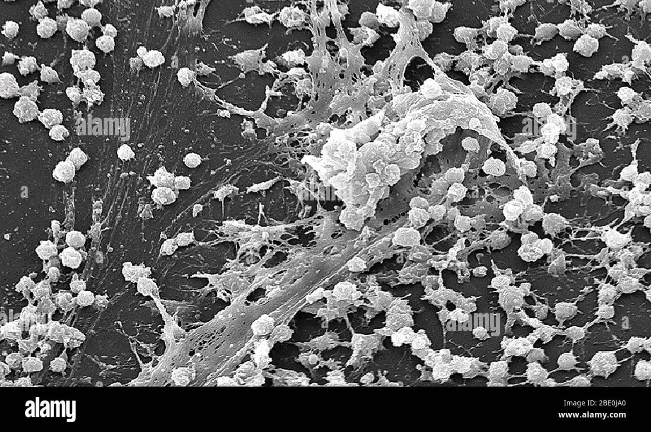 Das Scan-Elektronenmikrograph (SEM)-Bild eines Staphylococcus-Biofilms basierte auf der Kultur, die von der inneren Oberfläche eines nadellosen Steckverbinders gewonnen wurde. Ein Biofilm ist eine Gruppe von Mikroorganismen, in denen Zellen aneinander haften und oft auch an einer Oberfläche. Diese adhärenten Zellen werden in eine schleimige extrazelluläre Matrix eingebettet, die aus extrazellulären polymerischen Substanzen (EPS) besteht. Die EPS-Komponenten werden von den Zellen im Biofilm produziert und sind typischerweise eine polymerische Konglomeration von extrazellulärer DNA, Proteinen und Polysacchariden. Diese Polysaccharide wurden visualisiert b Stockfoto
