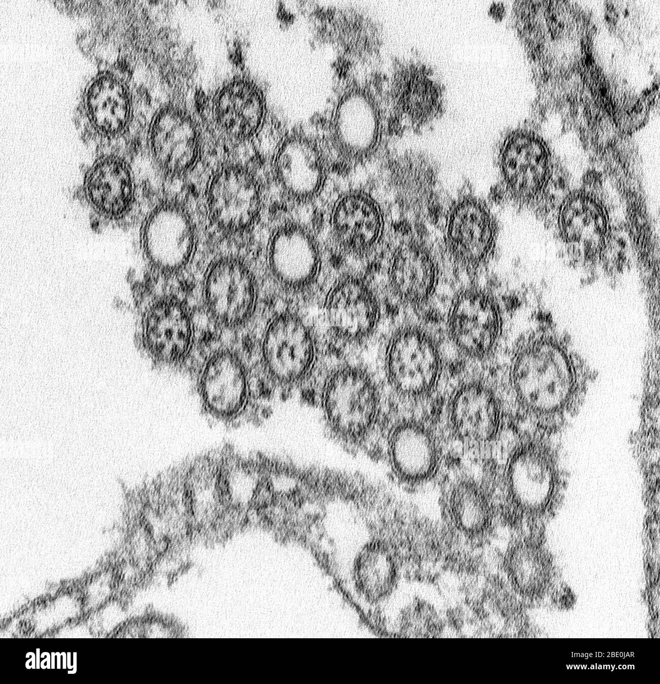 Transmission Electron Micrograph (TEM), der die Anzahl der Virionen aus einem neuartigen Grippe H1N1 Isolat darstellt. Das neuartige H1N1 (früher als „Weingrippe“ bezeichnet) ist ein neues Grippevirus, das bei Menschen Krankheiten verursacht. Dieses neue Virus wurde erstmals im April 2009 bei Menschen in den Vereinigten Staaten entdeckt. Dieses Virus breitet sich weltweit von Mensch zu Mensch aus, wahrscheinlich in der gleichen Weise wie sich regelmäßige saisonale Grippeviren ausbreiten. Am 11. Juni 2009 signalisierte die Weltgesundheitsorganisation (WHO), dass eine Pandemie der neuartigen H1N1-Grippe im Gange sei. Dieses Virus wurde ursprünglich als "Weingrippe" bezeichnet, weil Laborator Stockfoto