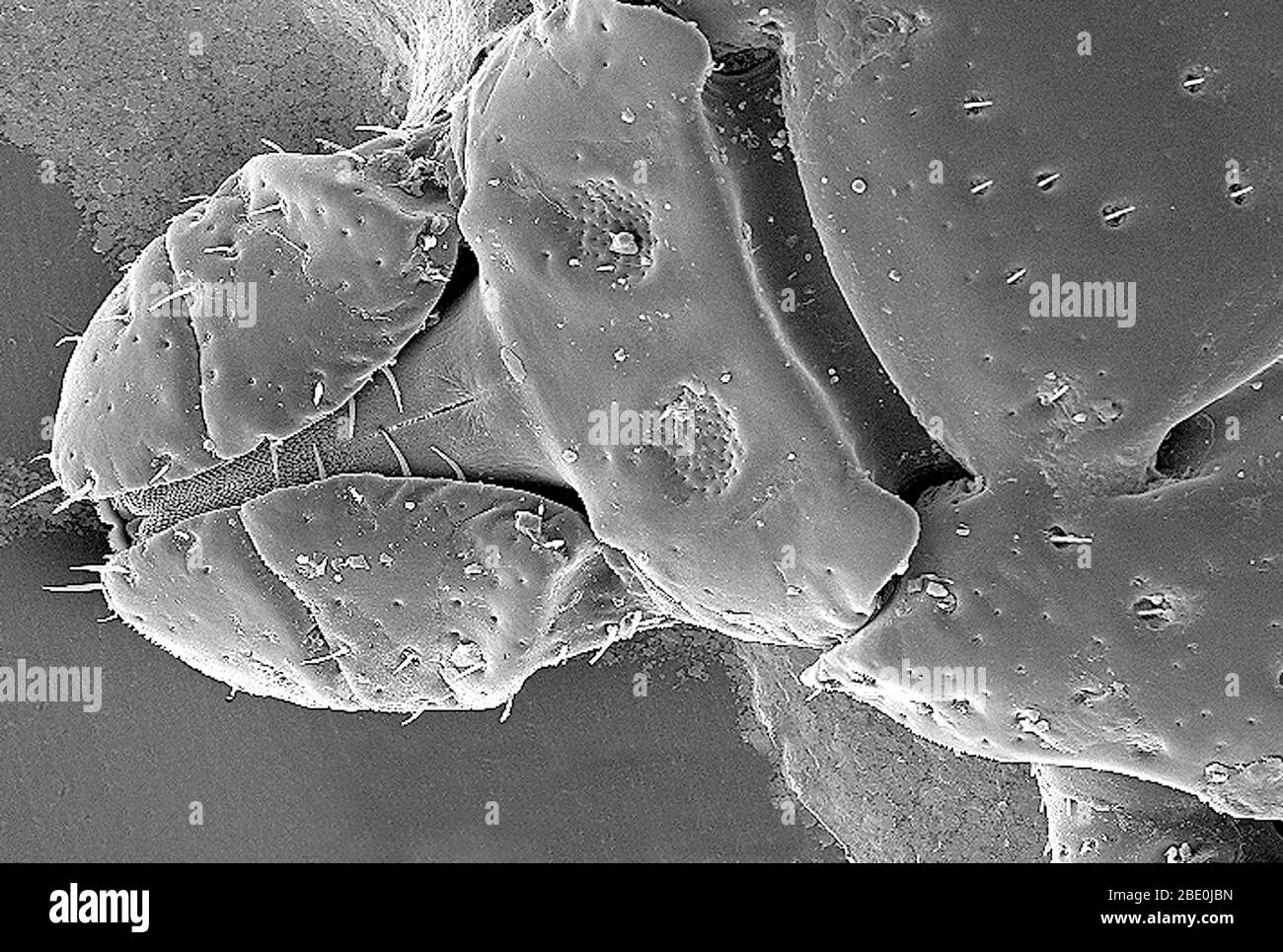 Scanning Electron Micrograph (SEM) zeigt die dorsale Ansicht eines Dermacentor variabilis. D. variabilis, auch bekannt als die amerikanische Hund Zecke oder Holzzicke, ist eine Art von Zecken, die bekannt ist, dass Bakterien für mehrere Krankheiten beim Menschen verantwortlich tragen, einschließlich Rocky Mountain Fleckfieber und Tularämie (Francisella tularensis). Es ist eine der bekanntesten harten Zecken. Krankheiten werden verbreitet, wenn es Blut vom Wirt saugt, das einige Tage dauern könnte, damit der Wirt einige Symptome erfahren kann. Vergrößerung: 98fach. Stockfoto