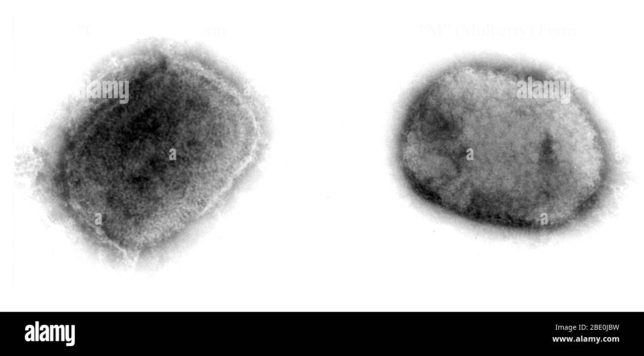 Negativ-gefärbte Transmission Electron Micrograph (TEM), die das gemauerte Monkeypox-Virus aus einer Zellkultur demonstriert. Das von einem Fleck durchdrungene Kapselvirion an der Oberfläche ist als scharf definierter, dichter Kern vorhanden, der von mehreren laminierten Zonen unterschiedlicher Dichte umgeben ist. Monkeypox-Virus (MPV) ist eine doppelsträngige DNA, ein zoonotisches Virus und eine Art der Gattung Orthopoxvirus in der Familie Poxviridae. Es ist eines der menschlichen Orthopoxviren, die Variola (VARV), Cowpox (CPX) und Vaccinia (VACV) Viren umfasst. Aber es ist kein direkter Vorfahre oder direkter Nachkomme des Variola-Virus w Stockfoto
