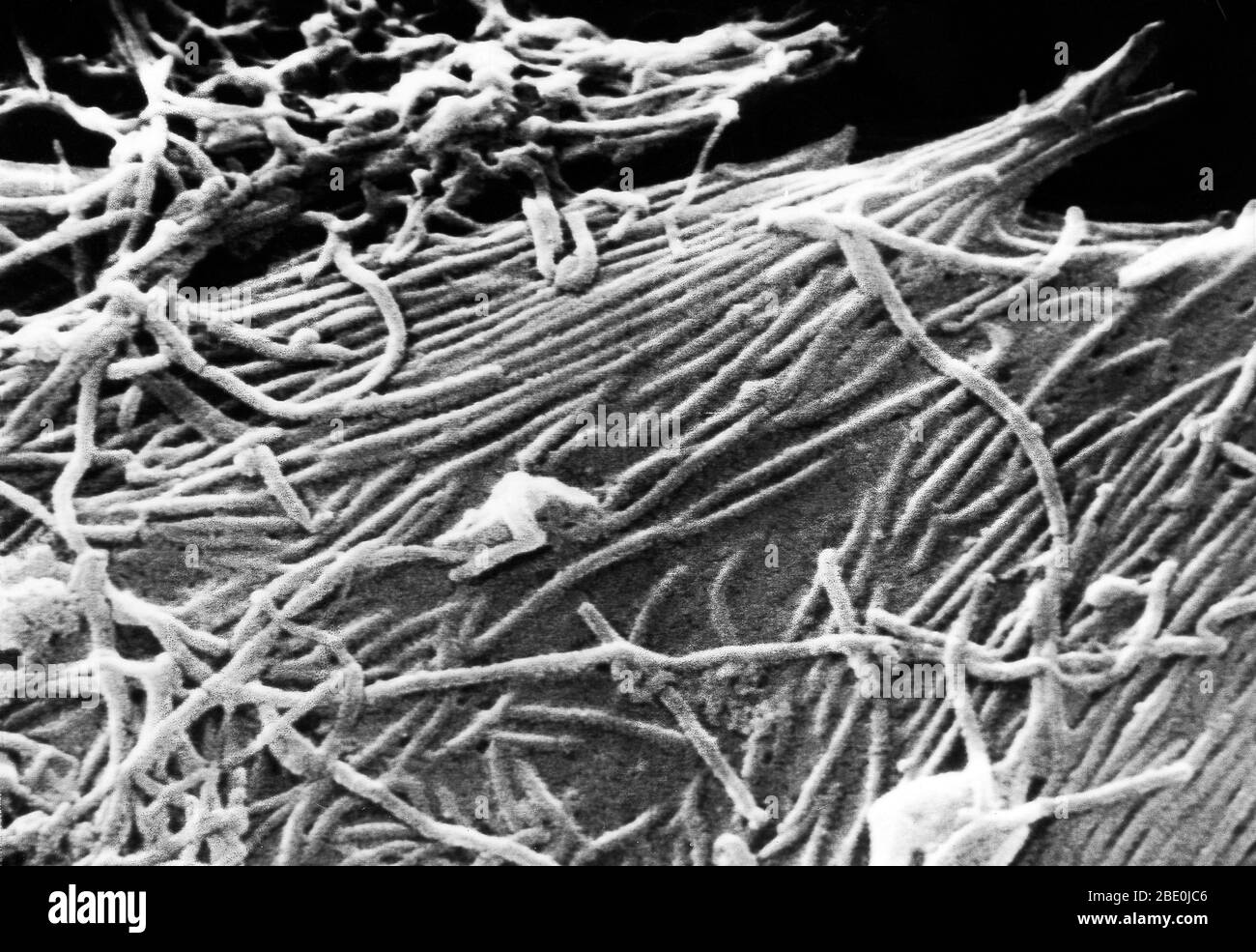 Rasterelektronenmikrograph (SEM) des Ebola-Virus. Das Virus wurde nach einem Fluss in der Demokratischen Republik Kongo benannt, wo es 1976 entdeckt wurde. Es ist ein RNA-Virus (aus der Familie Filoviridae), das bekannt ist, die oft tödliche Krankheit Ebola hämorragisches Fieber (Ebola HF) bei Primaten zu verursachen. Ebola-Virus (EBOV, früher Zaire ebolavirus) ist eines von fünf bekannten Viren innerhalb der Gattung Ebolavirus. Vier der fünf bekannten Ebola-Viren, darunter EBOV, verursachen bei Menschen und anderen Säugetieren ein schweres und oft tödliches hämorrhagisches Fieber, das als Ebola-Viruserkrankung (EVD) bekannt ist. Ebola-Virus hat c Stockfoto
