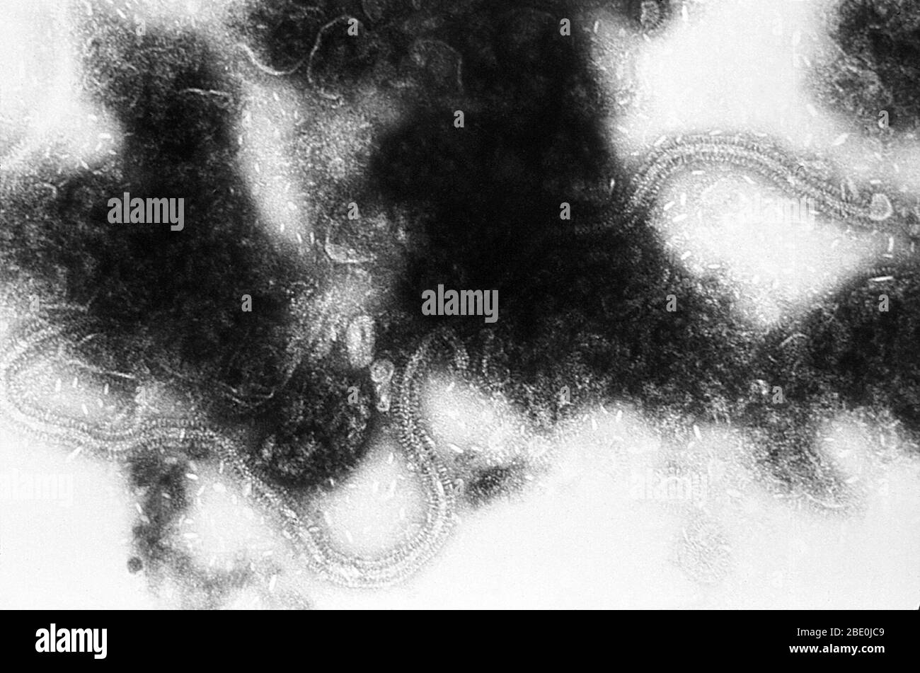 Transmission Electron Micrograph (TEM) des Erregers des humanen Synzytialvirus. Das humane respiratorische Synzytialvirus (HRSV) ist ein negativ-sinniges, einsträngiges RNA-Virus der Familie Pneumoviridae. Sein Name kommt von der Tatsache, dass F-Proteine auf der Oberfläche des Virus verursachen die Zellmembranen auf nahe gelegenen Zellen zu verschmelzen, bilden Synzytia. HRSV ist ein synzytielles (multinationale Zelle, die aus mehreren Zellfusionen von uninuklearen Zellen resultieren kann) Virus, das Infektionen der Atemwege verursacht. Es ist eine Hauptursache für Infektionen der unteren Atemwege und Krankenhausbesuche während der Kindheit und c Stockfoto