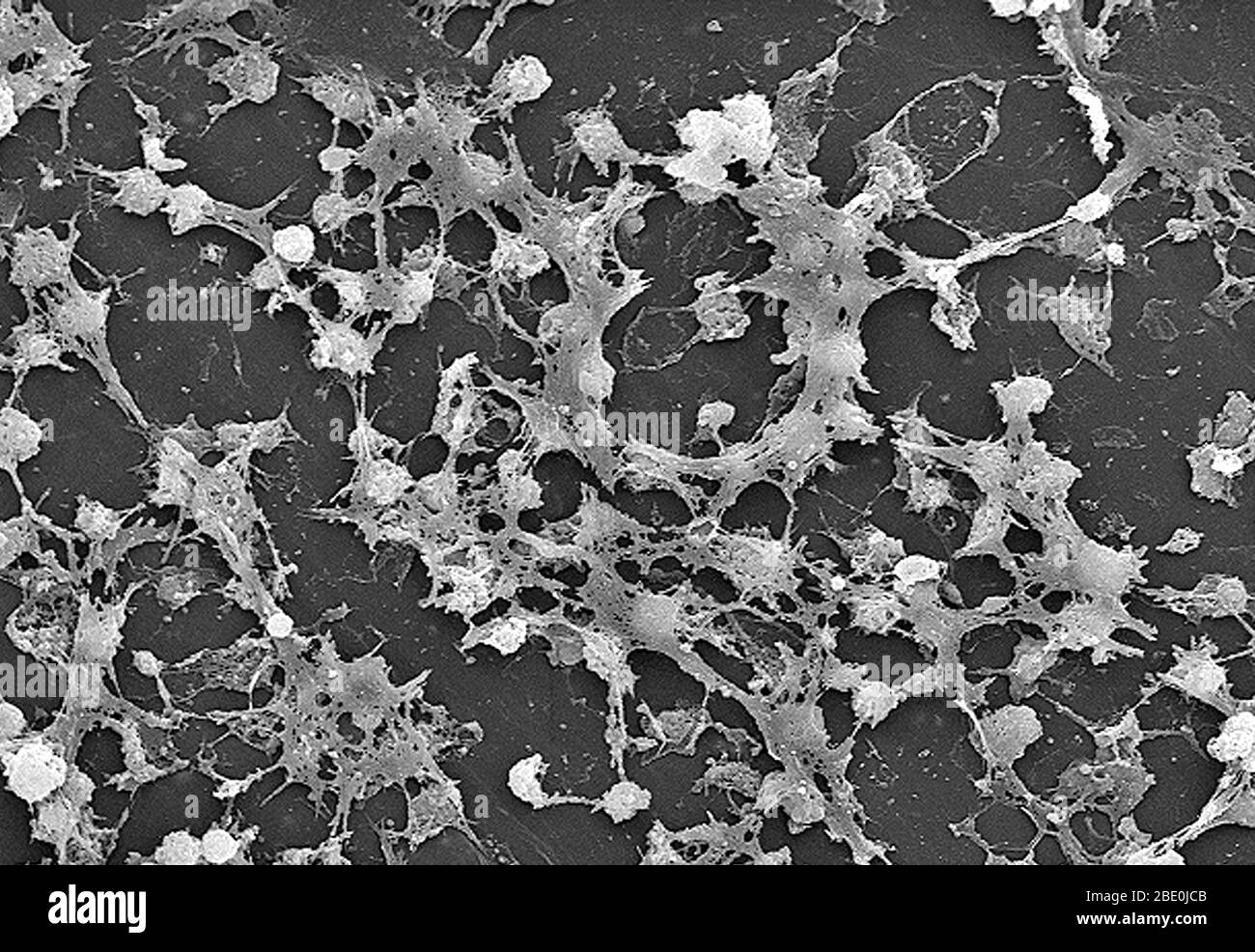 Scanning Electron Micrograph (SEM), der eine große Anzahl von Staphylococcus aureus Bakterien darstellt, die auf der luminalen Oberfläche eines Indwelling-Katheters gefunden wurden. Von Bedeutung ist die klebrig aussehende Substanz, die zwischen den runden Cocci-Bakterien gewebt wurde, die aus Polysacchariden bestand und als Biofilm bekannt ist. Dieser Biofilm wurde gefunden, um die Bakterien, die die Substanz vor Angriffen durch antimikrobielle Mittel wie Antibiotika absondern zu schützen. Staphylococcus aureus, auch bekannt als ''golden Staph'' und Oro Staphira, ist ein fakultatives anaerobes grampositives Kokkkkakterium. Staph Bakterien sind auf Stockfoto