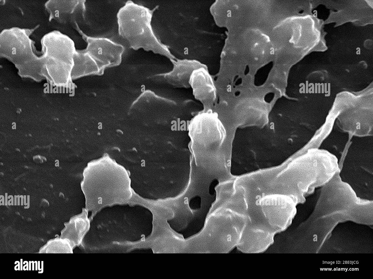 Scanning Electron Micrograph (SEM), der eine große Anzahl von Staphylococcus aureus Bakterien darstellt, die auf der luminalen Oberfläche eines Indwelling-Katheters gefunden wurden. Von Bedeutung ist die klebrig aussehende Substanz, die zwischen den runden Cocci-Bakterien gewebt wurde, die aus Polysacchariden bestand und als Biofilm bekannt ist. Dieser Biofilm wurde gefunden, um die Bakterien, die die Substanz vor Angriffen durch antimikrobielle Mittel wie Antibiotika absondern zu schützen. Staphylococcus aureus, auch bekannt als ''golden Staph'' und Oro Staphira, ist ein fakultatives anaerobes grampositives Kokkkkakterium. Staph Bakterien sind auf Stockfoto