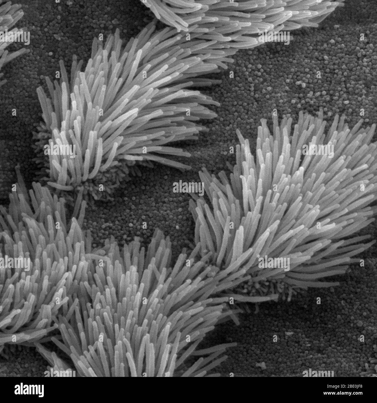 Scanning Electron Micrograph (SEM) der Lunge Luftröhre Epithel. Es gibt sowohl ciliated und nicht-ciliated Zellen in diesem Epithel. Beachten Sie den Unterschied in der Größe zwischen den Wimpern und die mikrovilli (auf die nicht-Ciliated cell Oberfläche). Vergrößerung: 5000x. Stockfoto