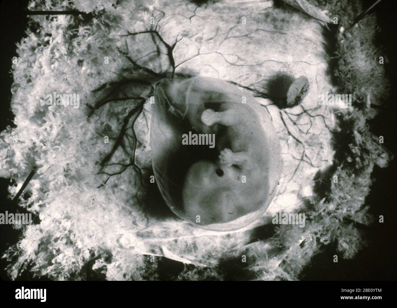 Ein menschlicher Embryo nach neununddreißig Tagen Entwicklung. Stockfoto