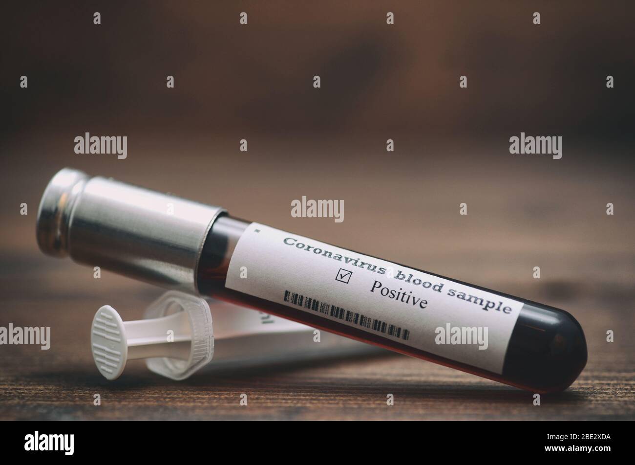 Coronavirus 2019-nCoV Blutprobe. Epidemisches Virus Respiratory Syndrome Stock-Foto. Corona-Virus-Ausbruch. Stock-Foto der Röhre mit Bluttest (Roman Stockfoto