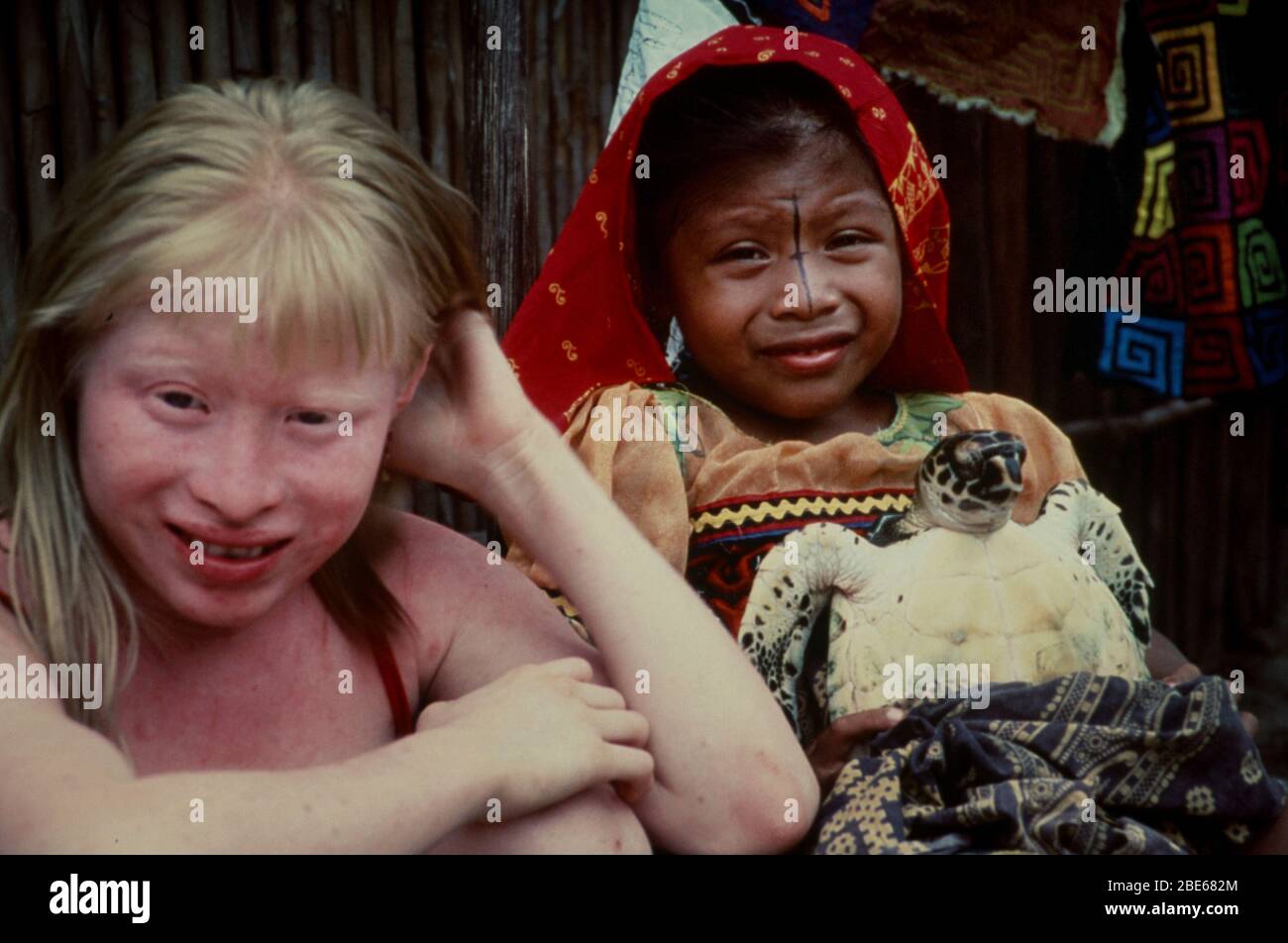 Albino Mädchen sitzt neben ihrem Freund, beide sind Kuna Yala (Guna Yala) Indianer, die in den tropischen San Blas Inseln, Karibik, Panama leben Stockfoto