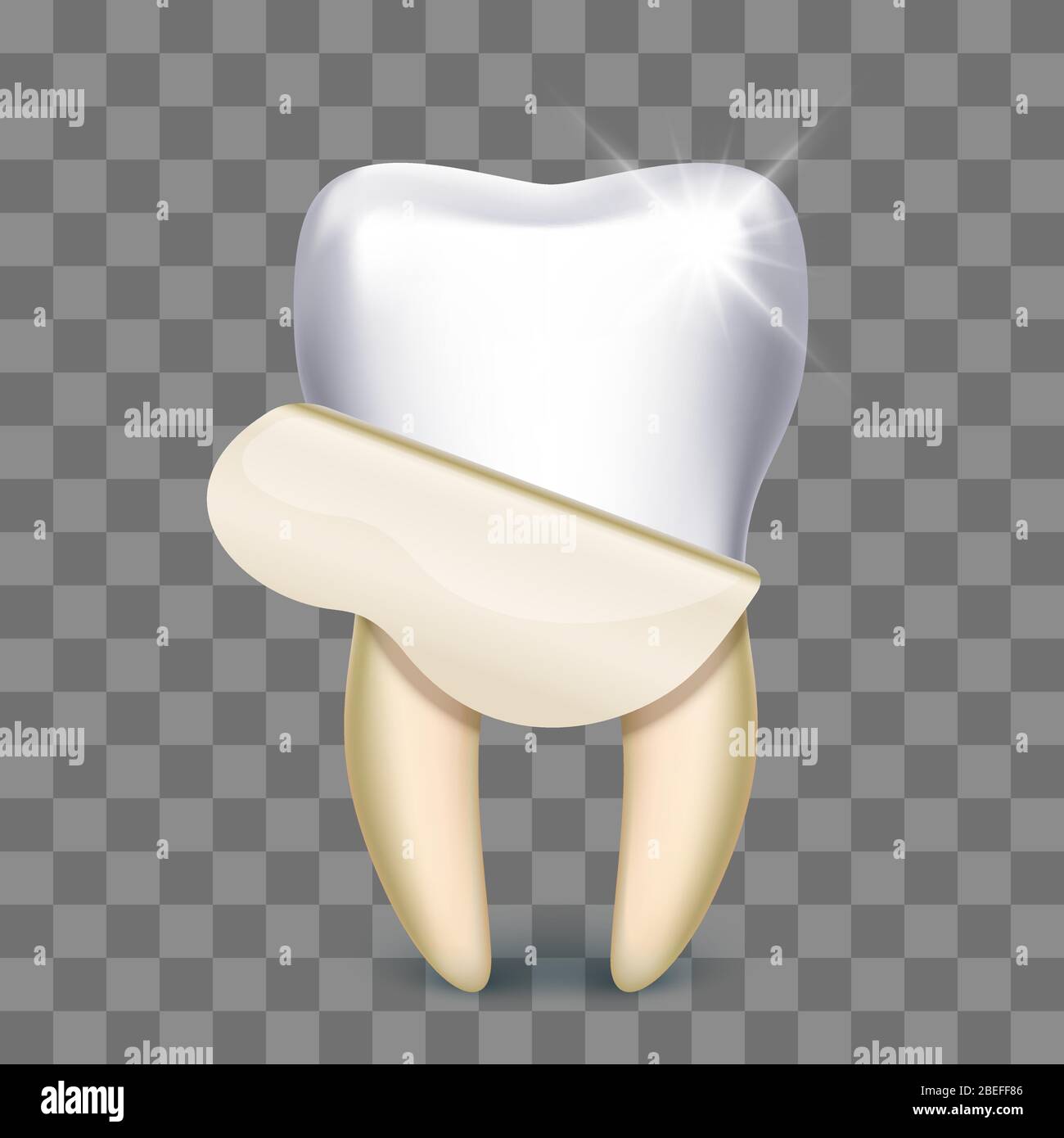 Zahnfurnier Zahnweiß Zahntechniker isoliert auf transparentem Hintergrund. Vektorgrafik Stock Vektor