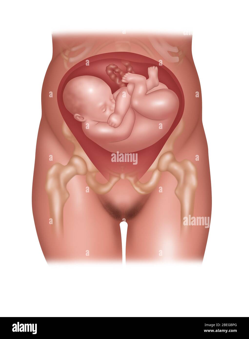 Fetus in Schulterposition, Abbildung Stockfoto